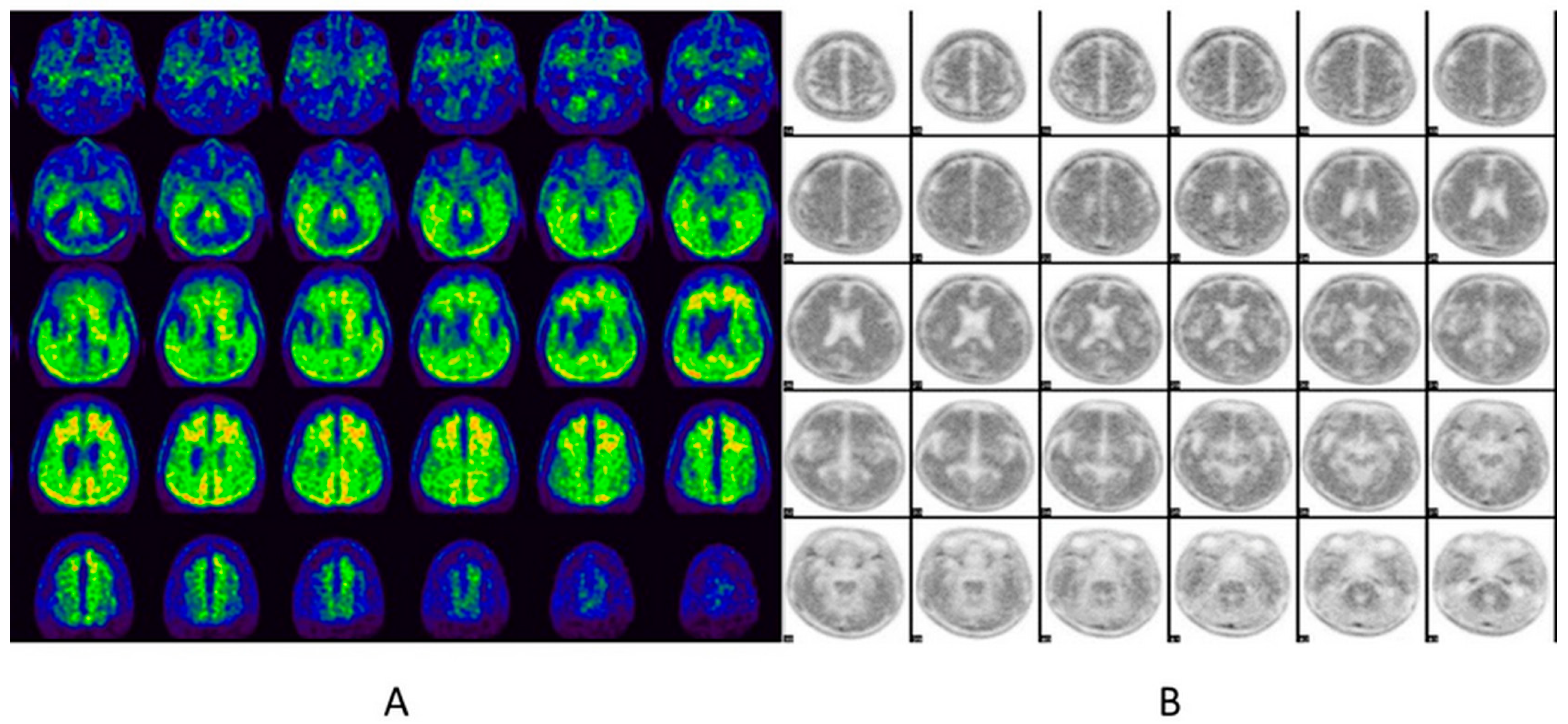 Diagnostics 14 02474 g005
