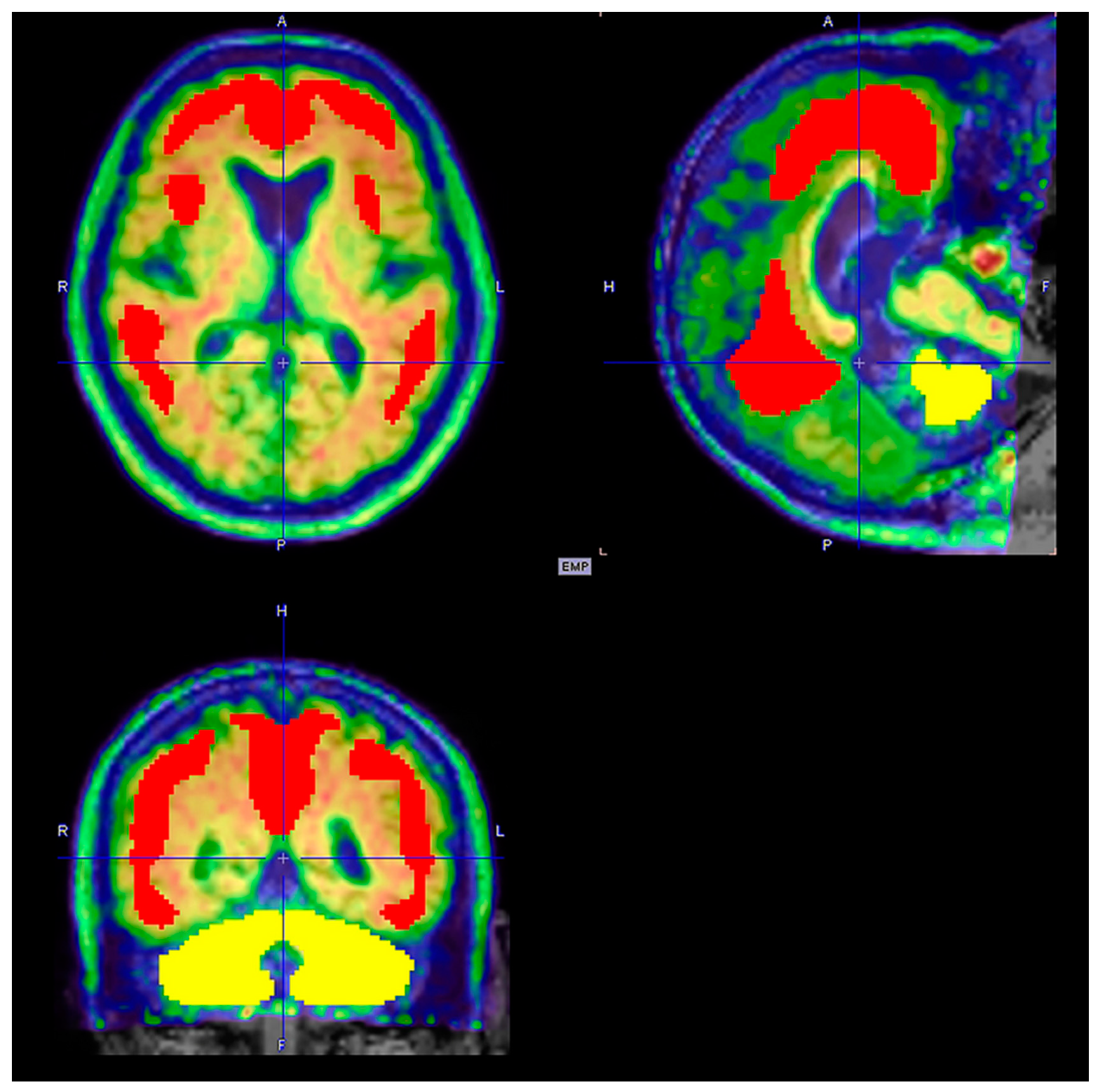 Diagnostics 14 02474 g006