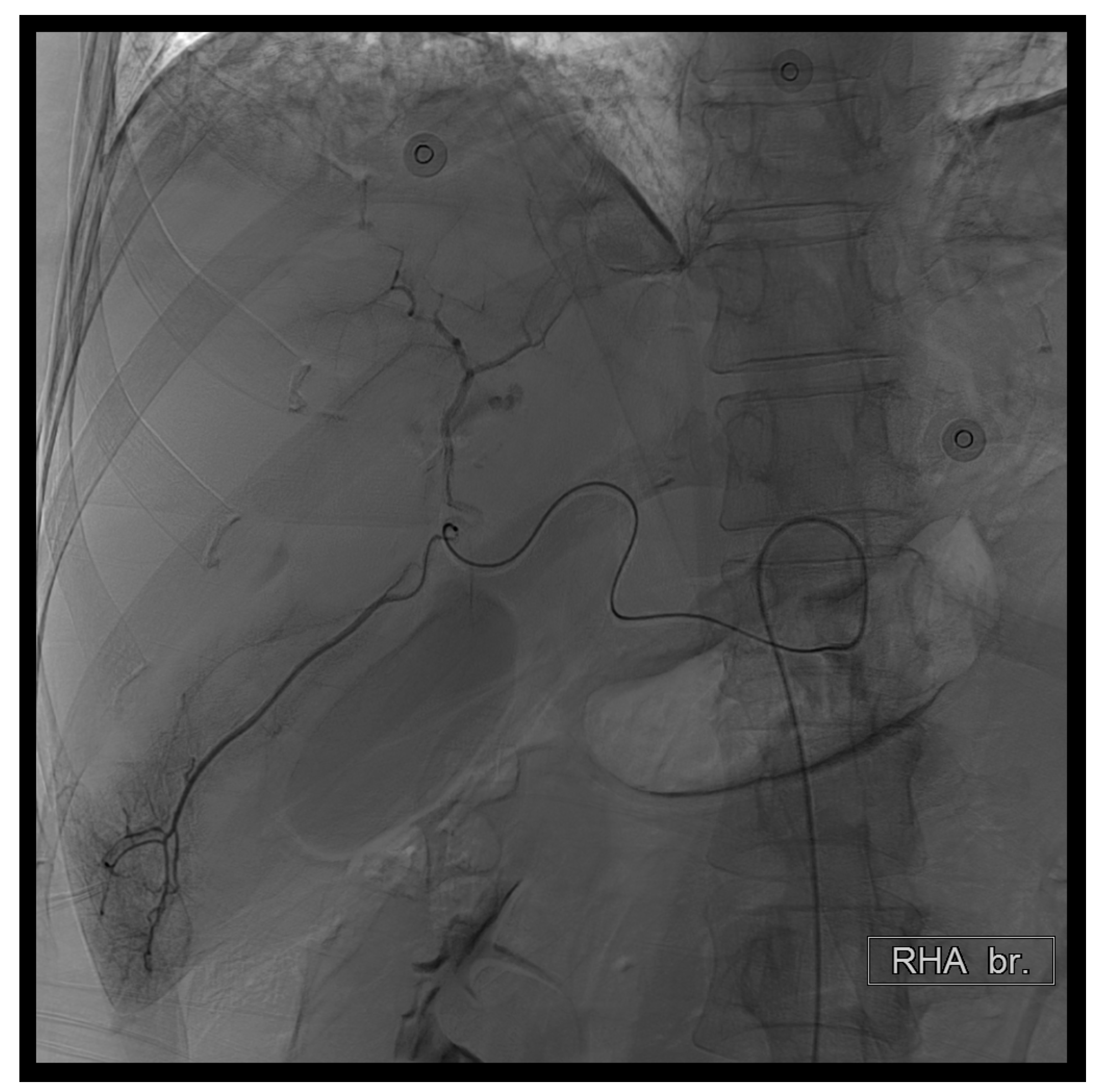 Diagnostics 14 02492 g004