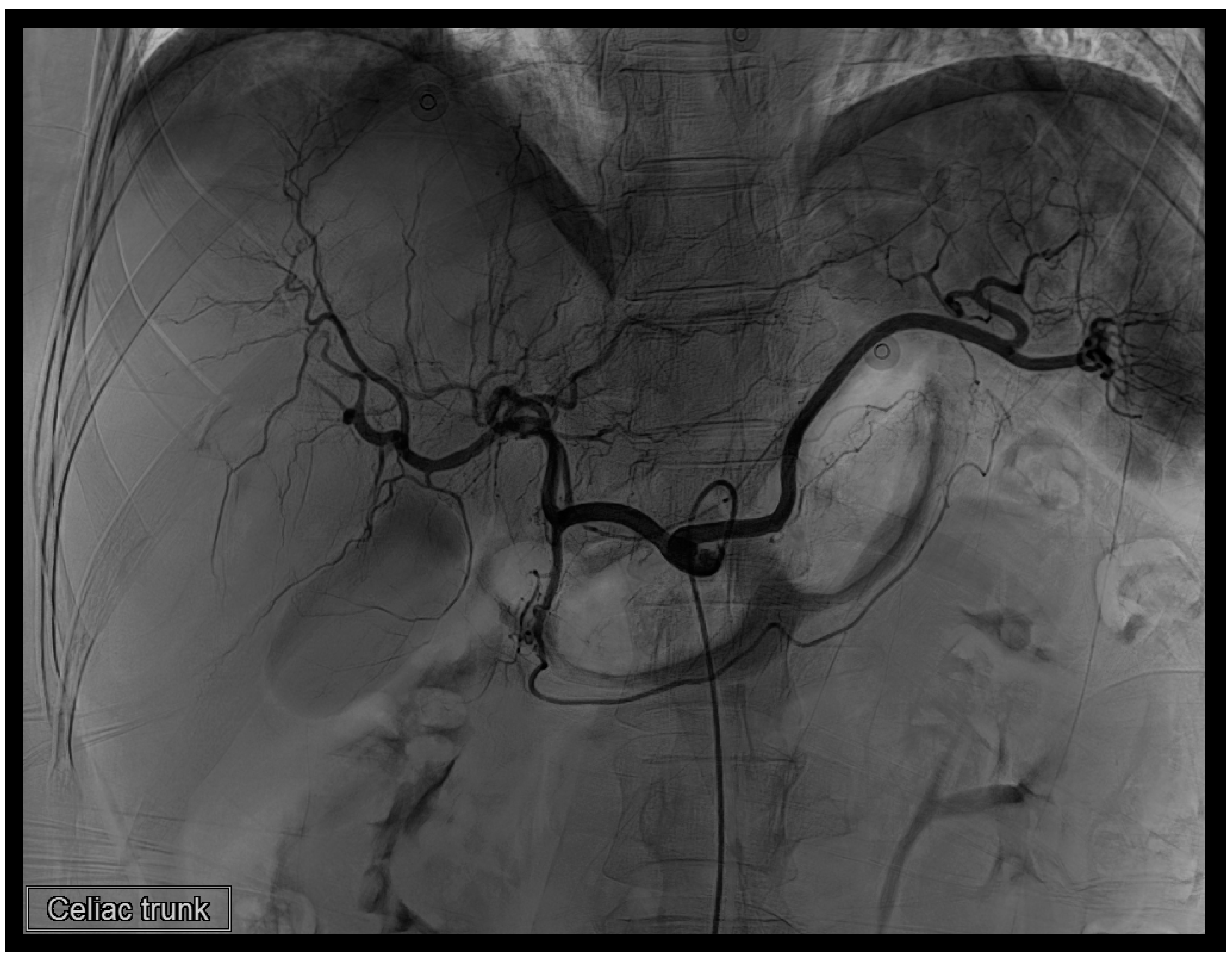 Diagnostics 14 02492 g005