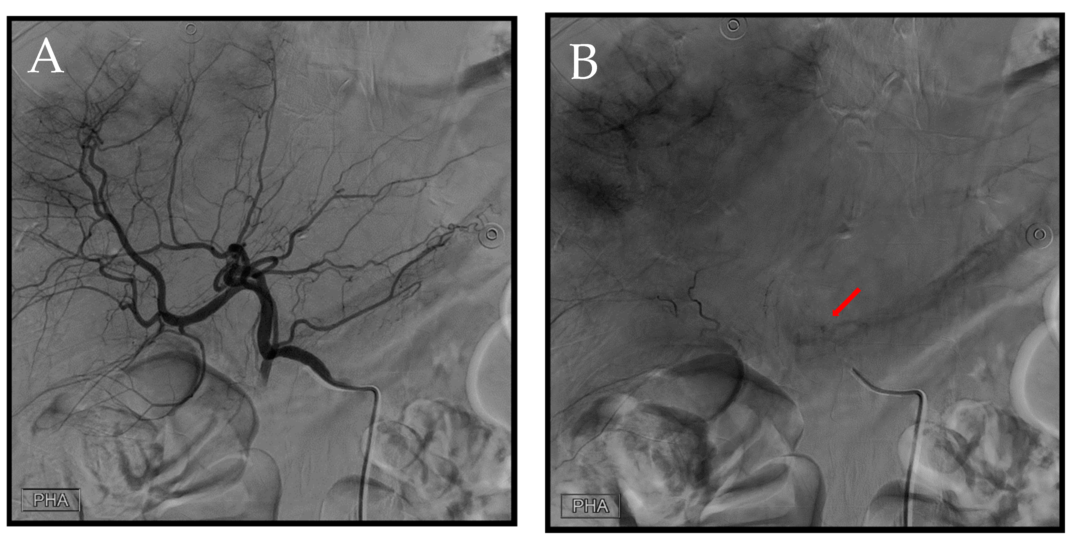 Diagnostics 14 02492 g006