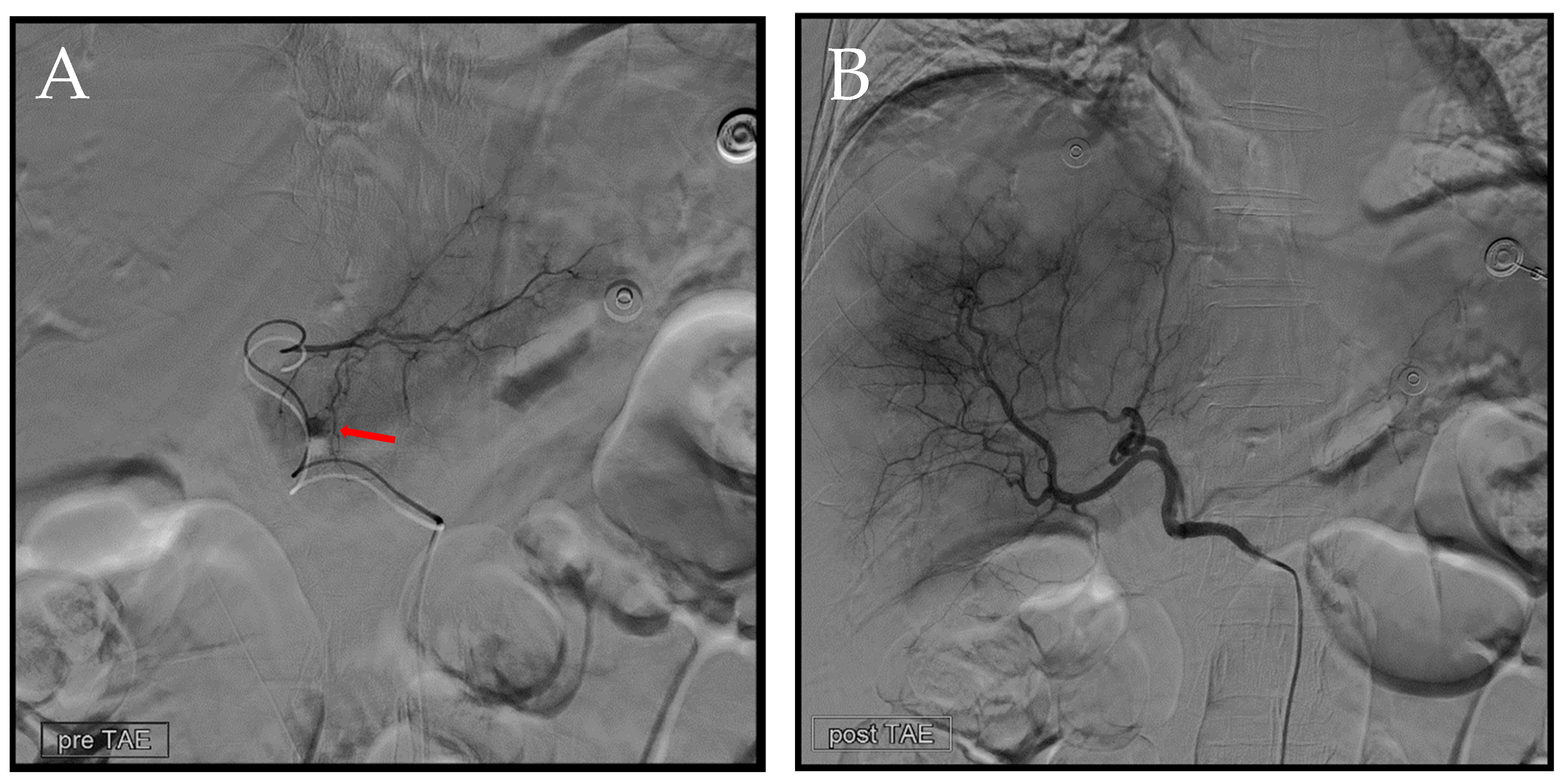 Diagnostics 14 02492 g007