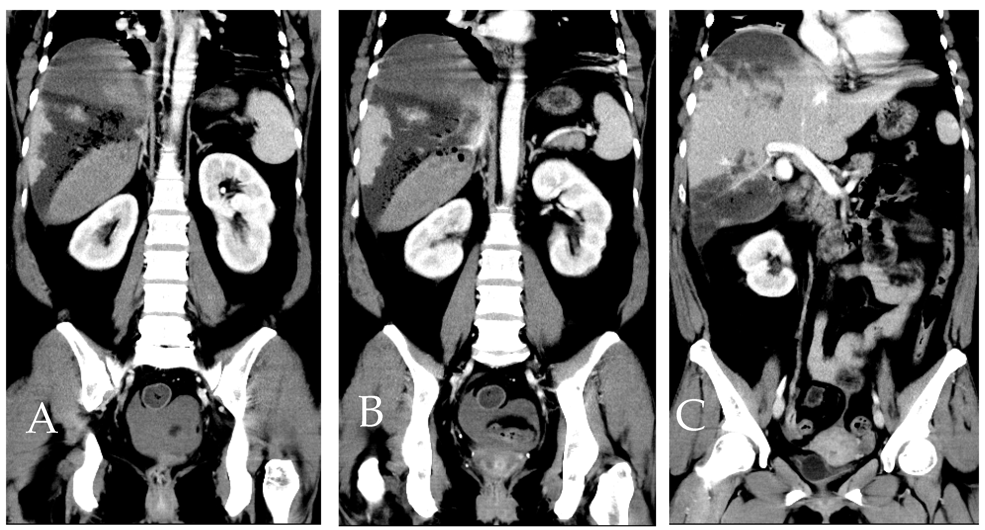Diagnostics 14 02492 g009