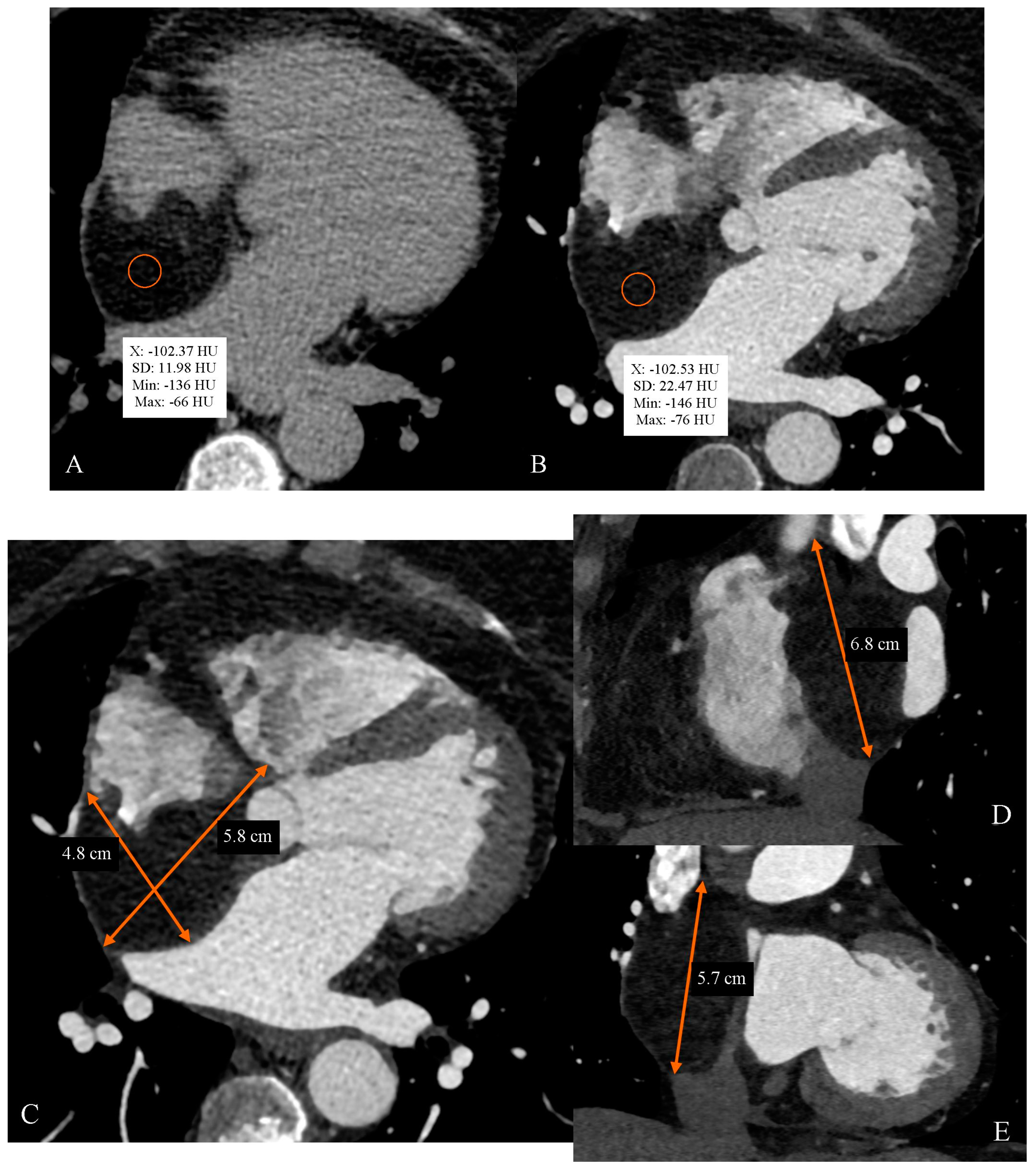 Diagnostics 14 02496 g001a Diagnostics 14 02496 g001a