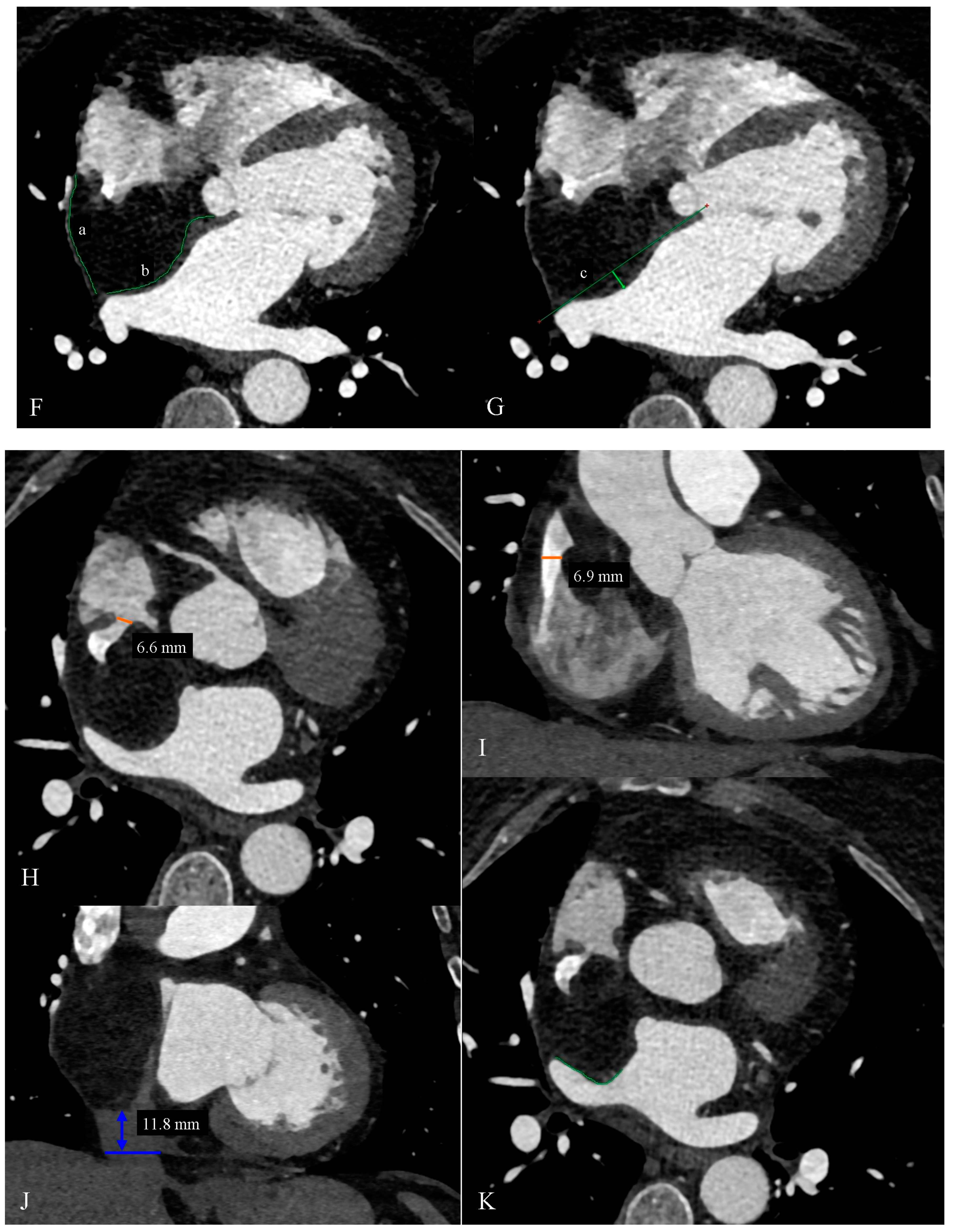Diagnostics 14 02496 g001b Diagnostics 14 02496 g001b