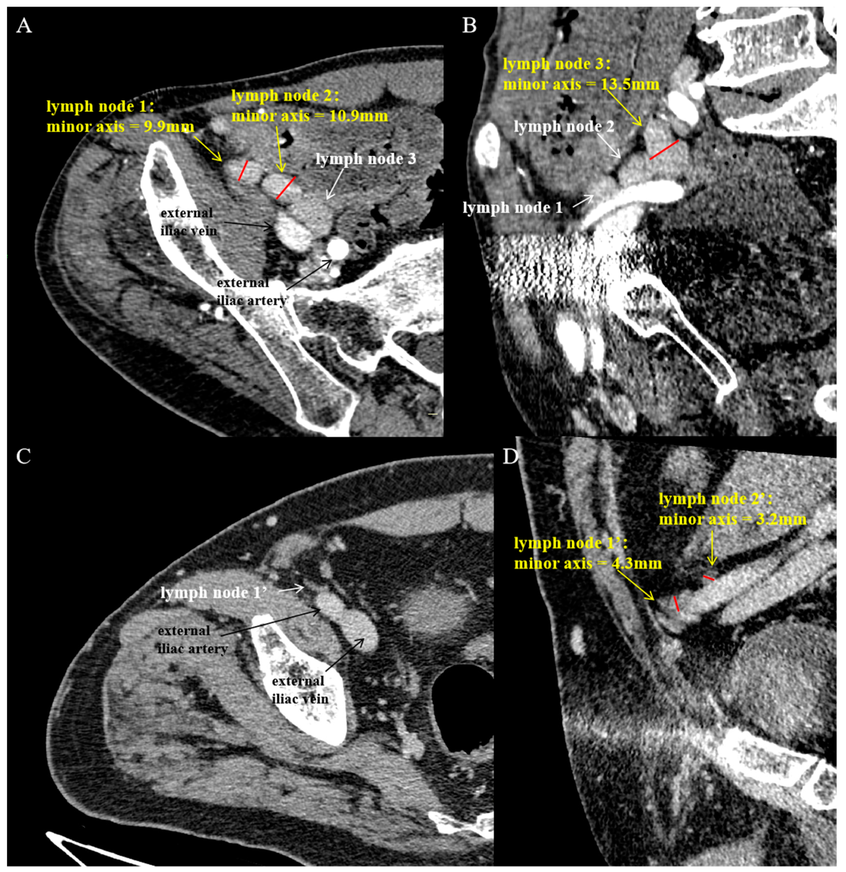 Diagnostics 14 02502 g002