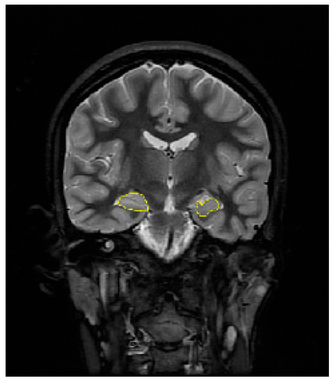 Diagnostics 14 02509 g003