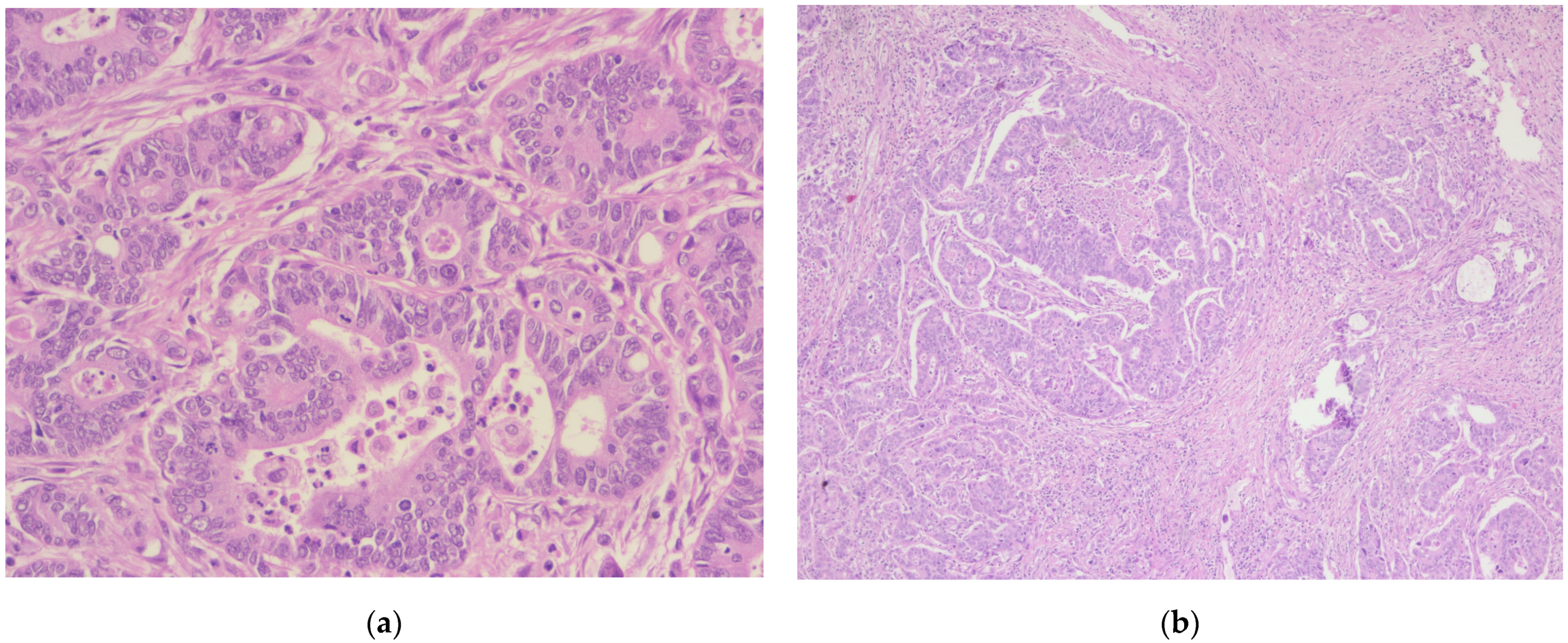 Diagnostics 14 02510 g005