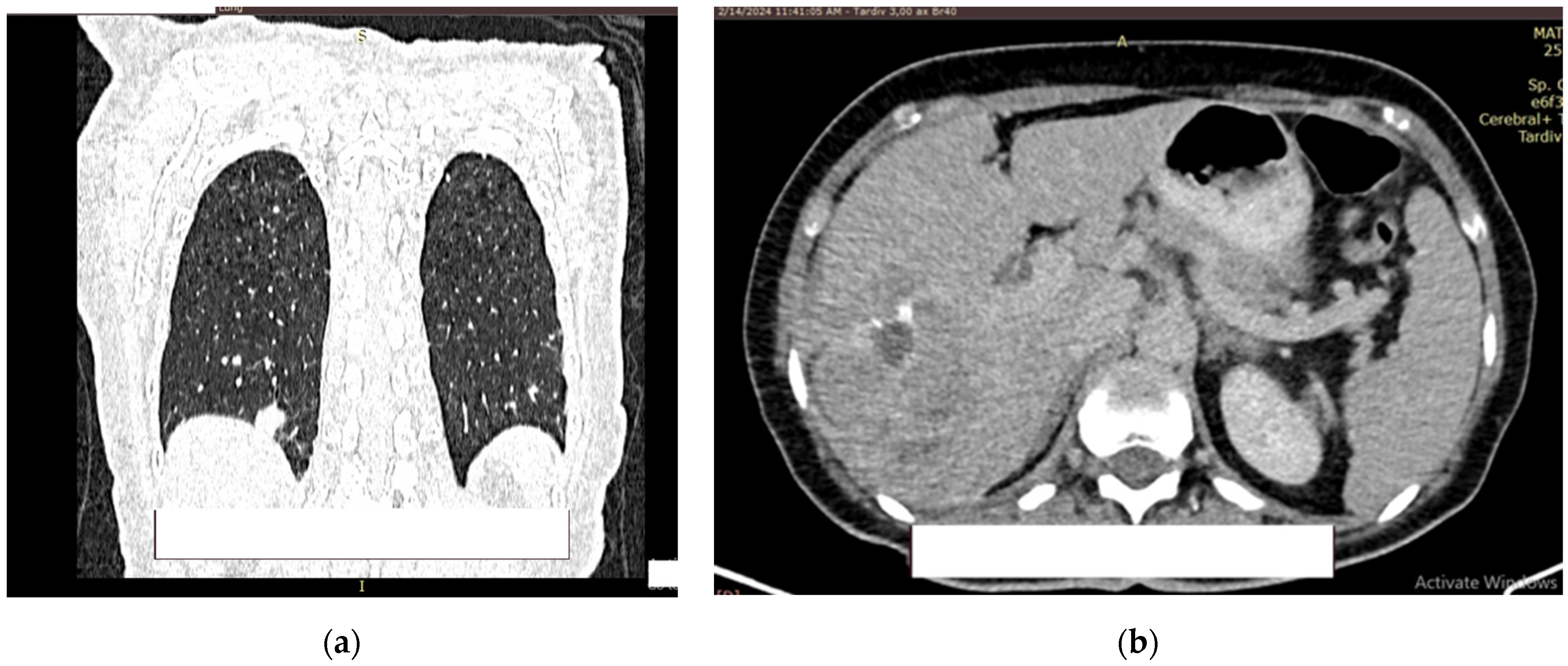 Diagnostics 14 02510 g008