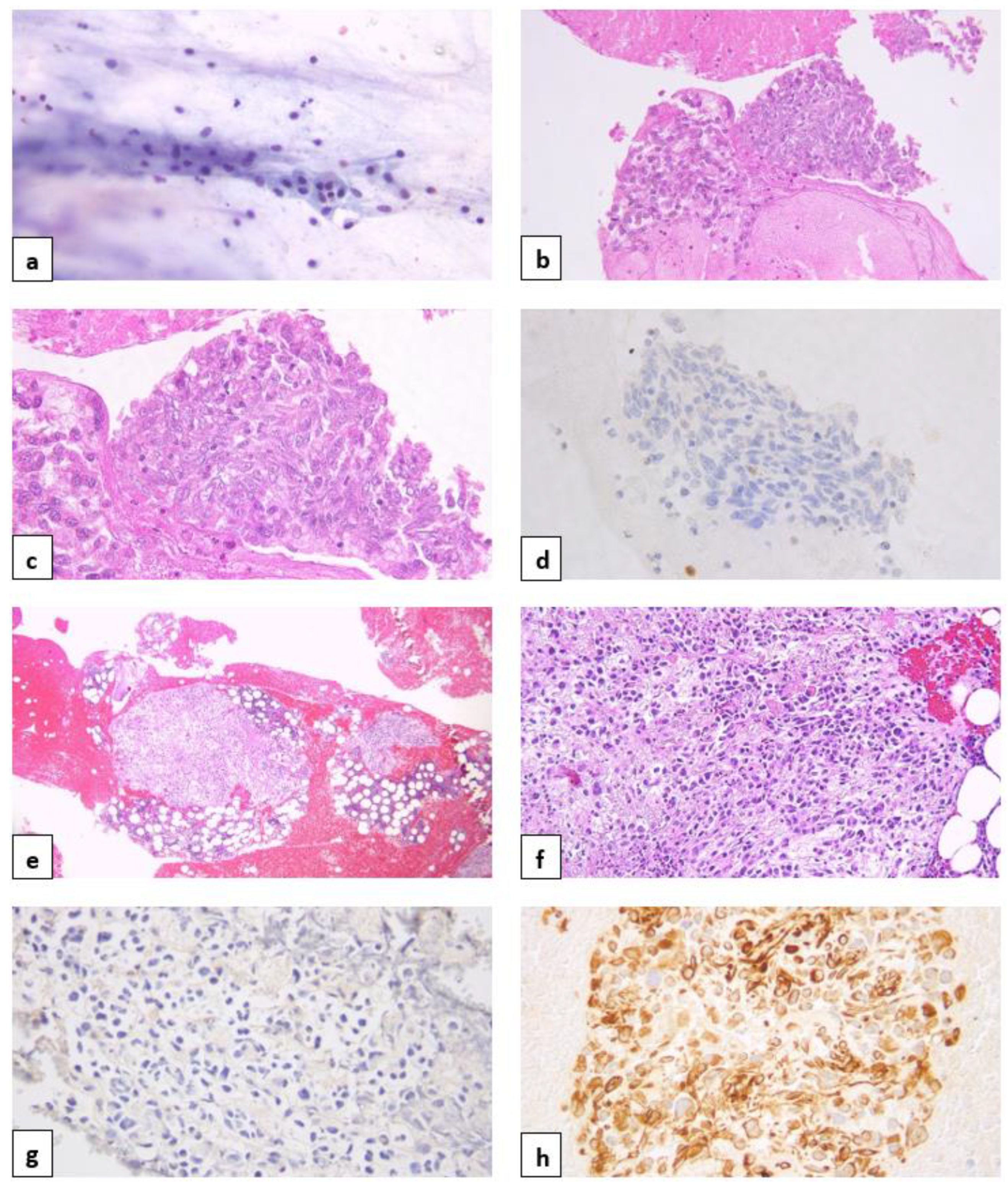 Diagnostics 14 02512 g001