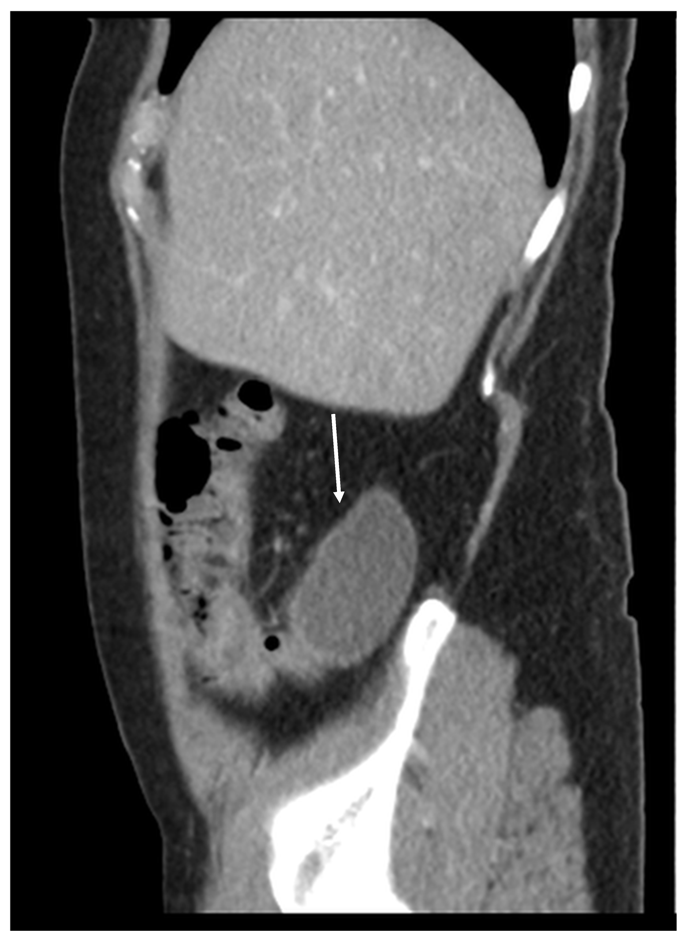 Diagnostics 14 02532 g001