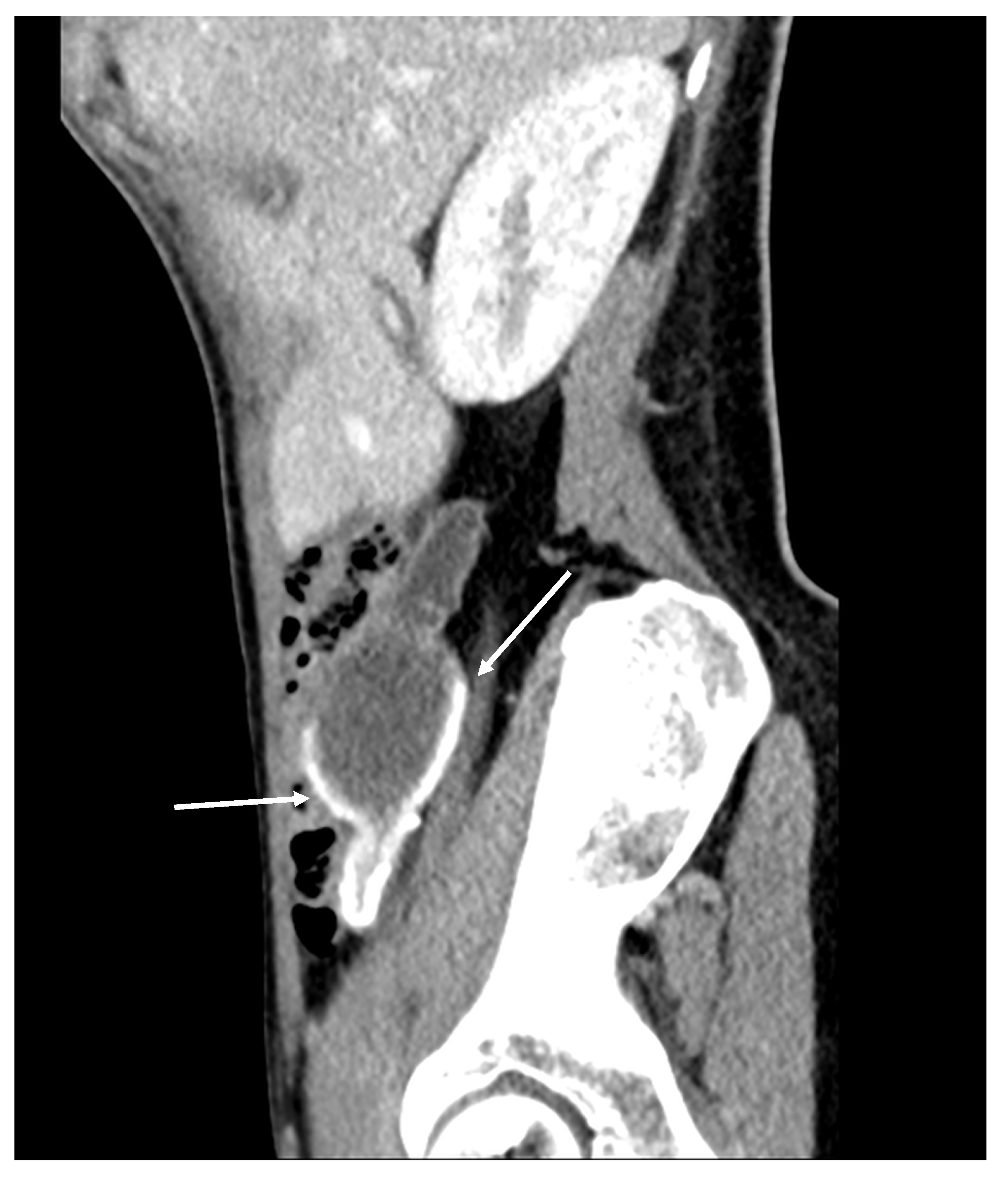 Diagnostics 14 02532 g002