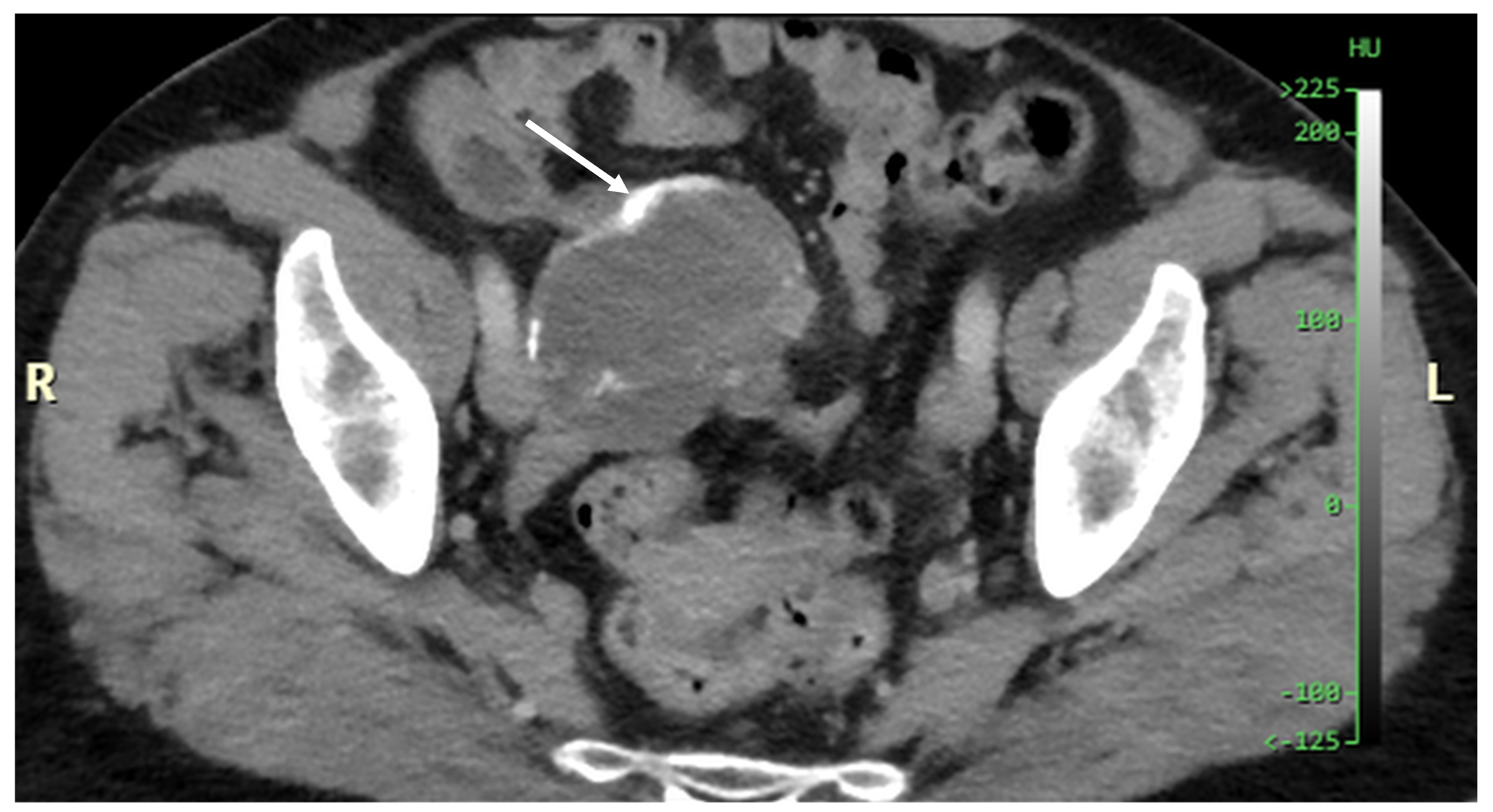 Diagnostics 14 02532 g003