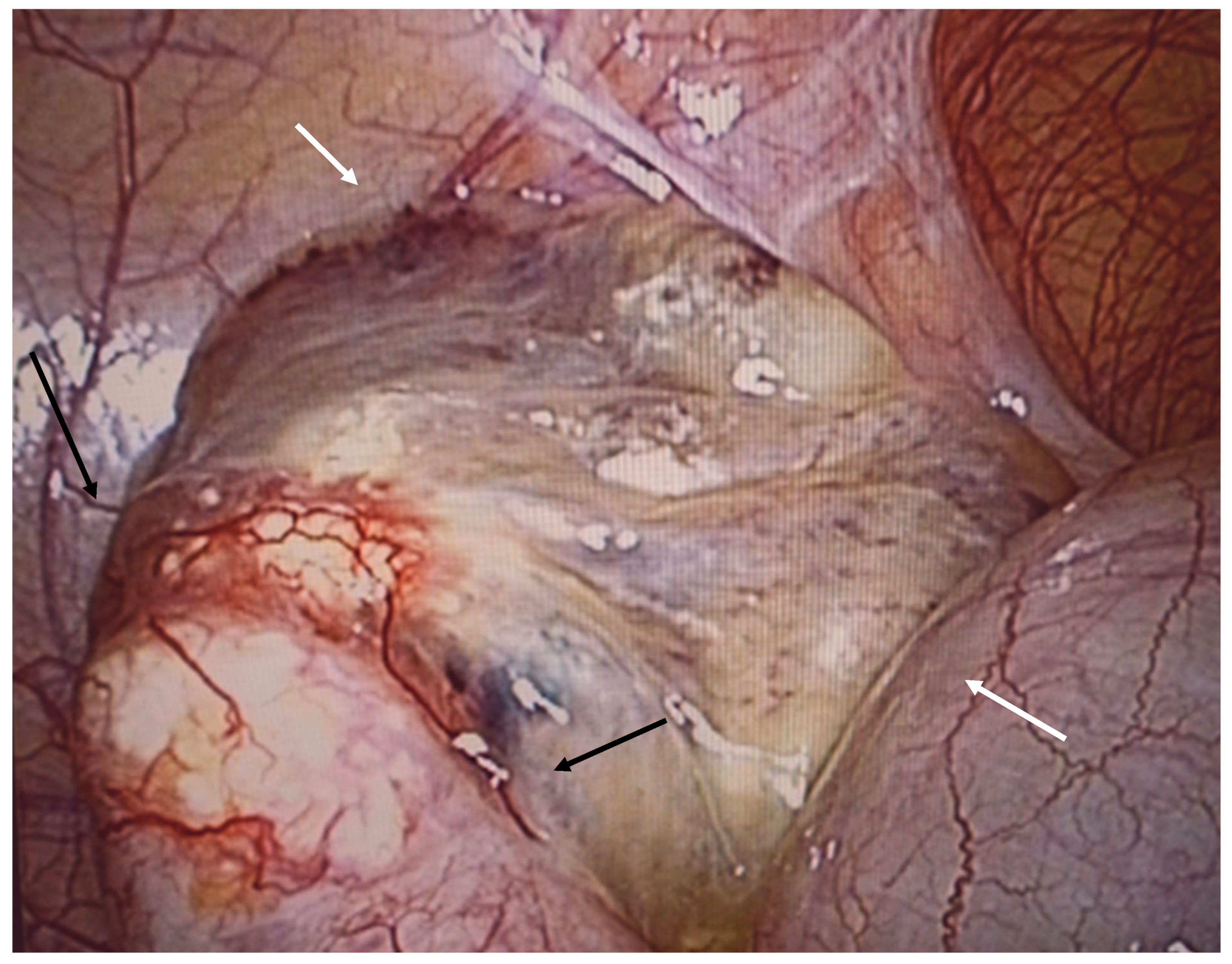 Diagnostics 14 02532 g010