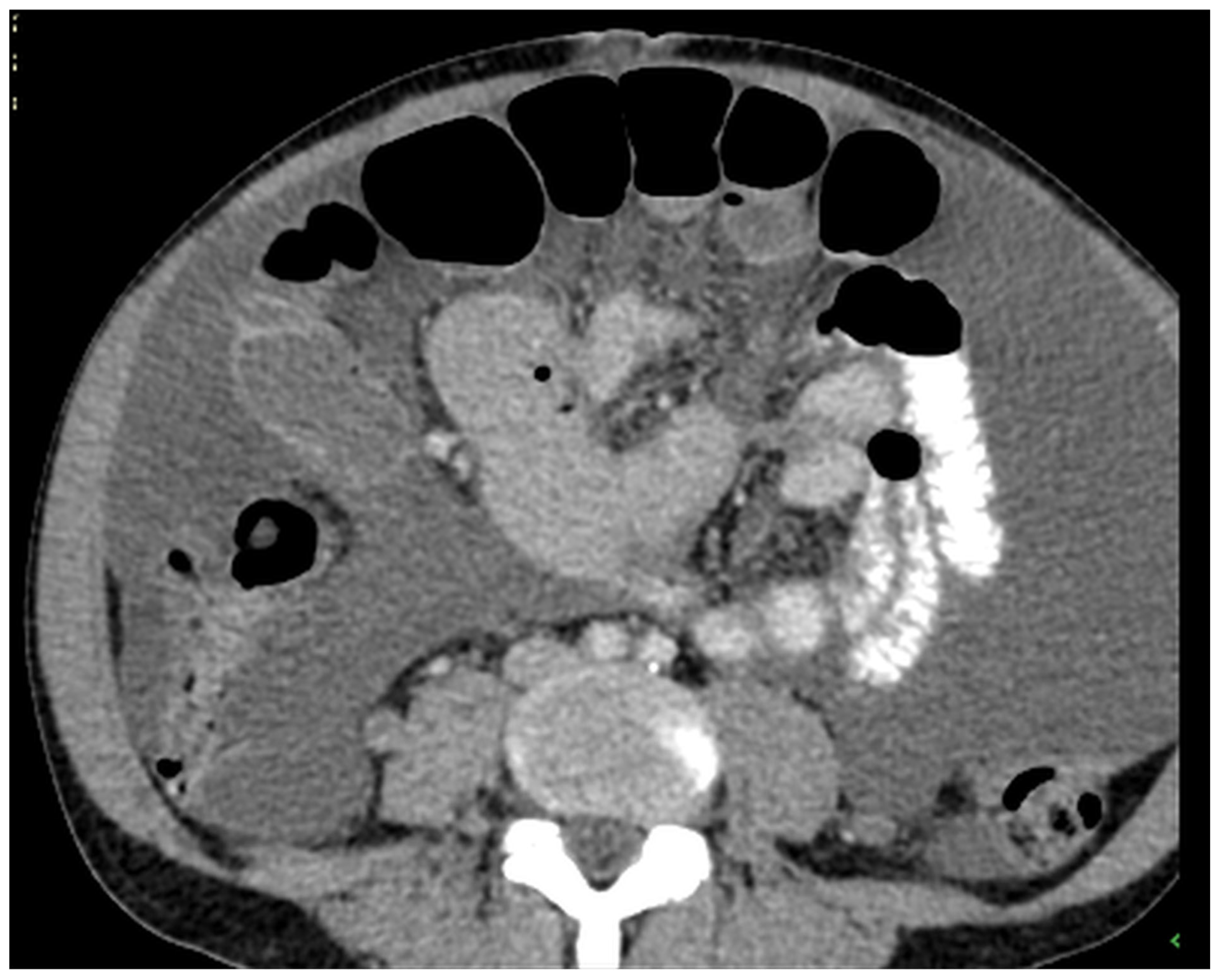Diagnostics 14 02532 g011