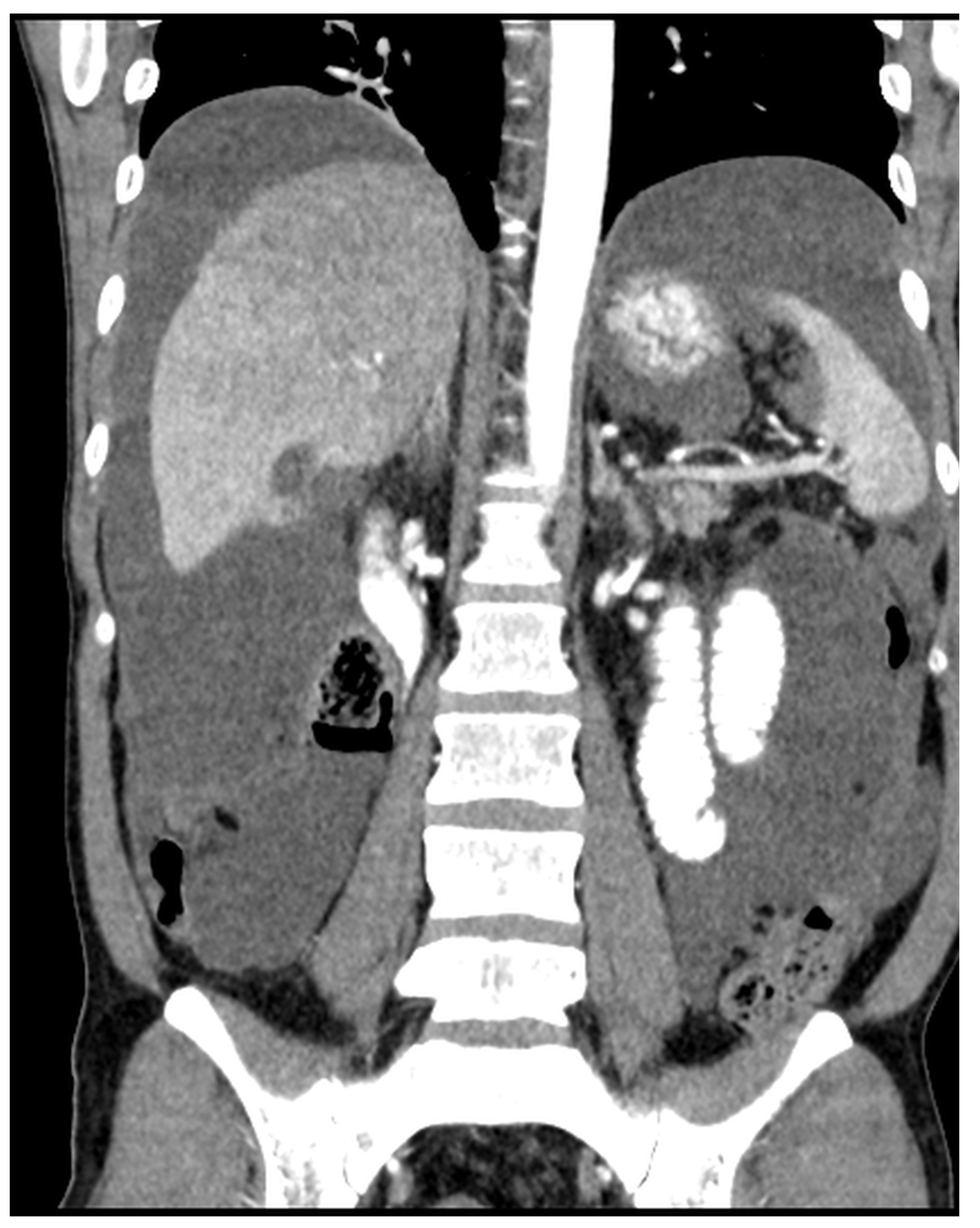 Diagnostics 14 02532 g012