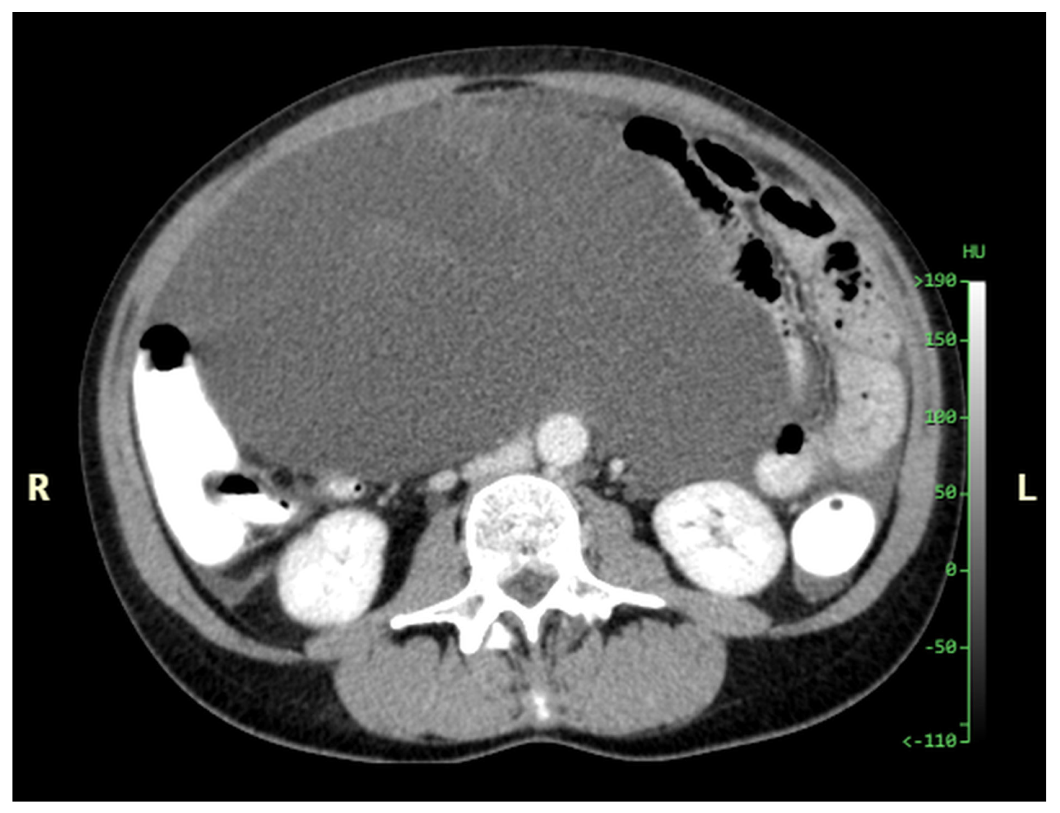 Diagnostics 14 02532 g013