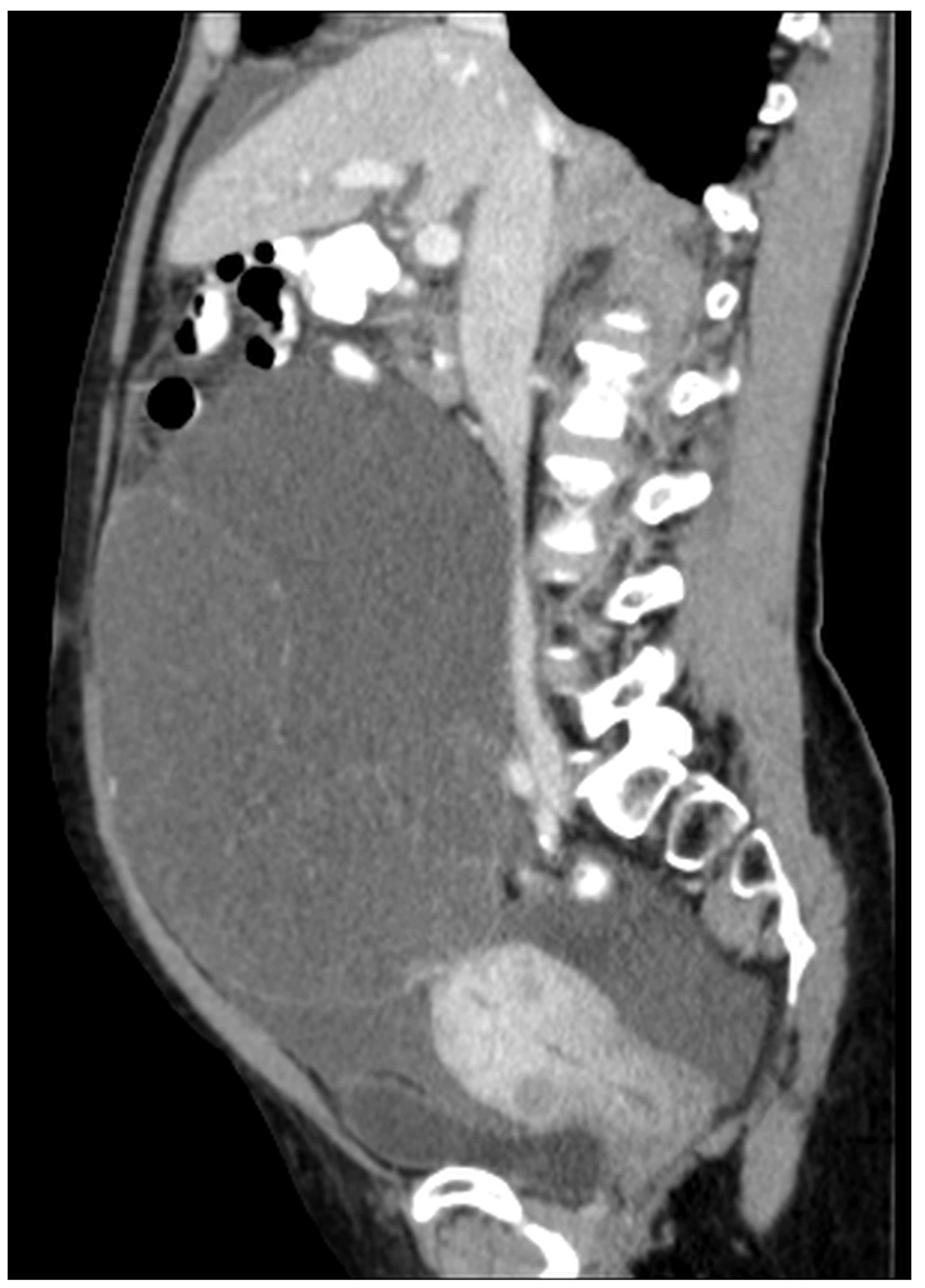 Diagnostics 14 02532 g015