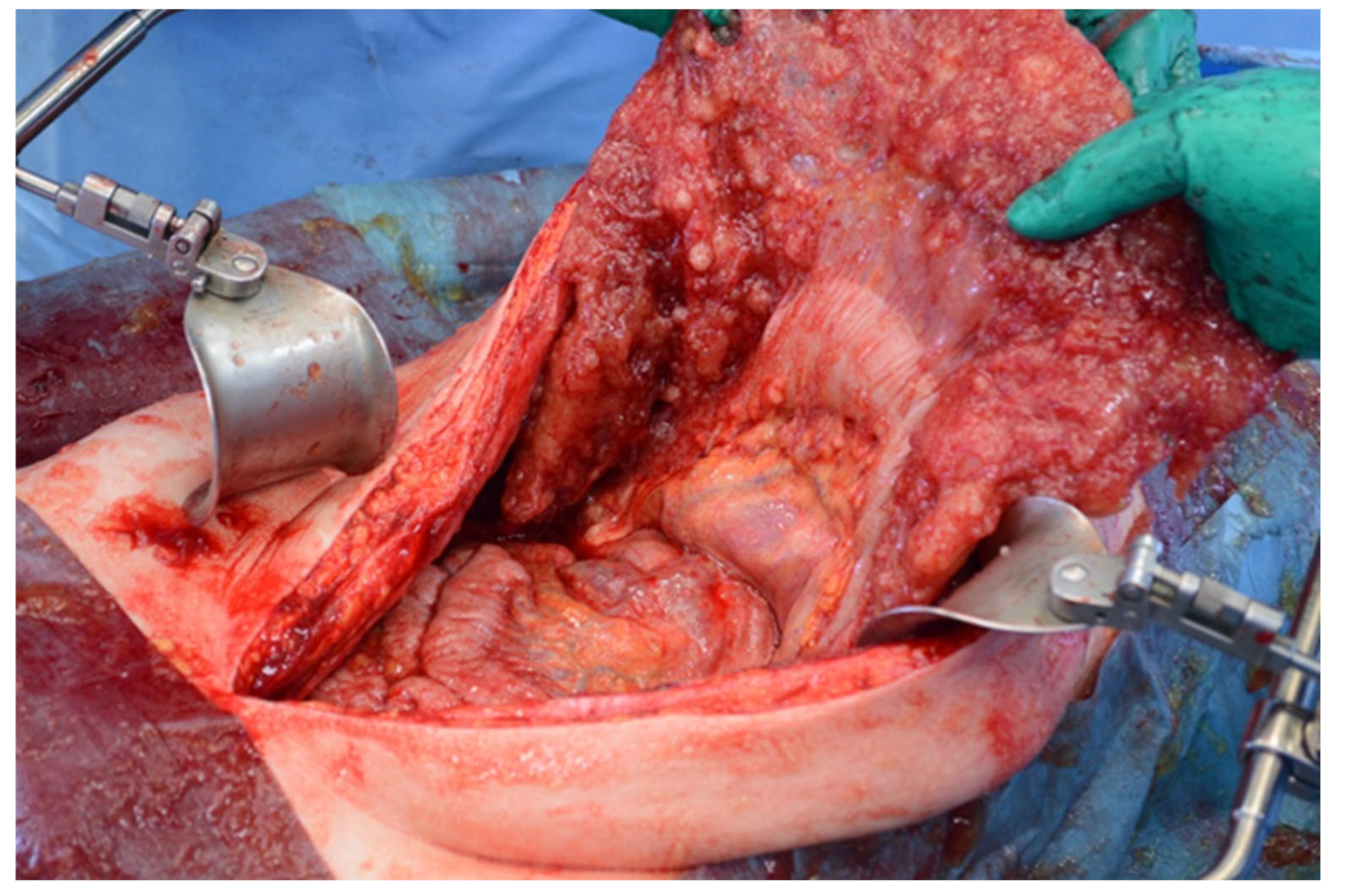 Diagnostics 14 02532 g017