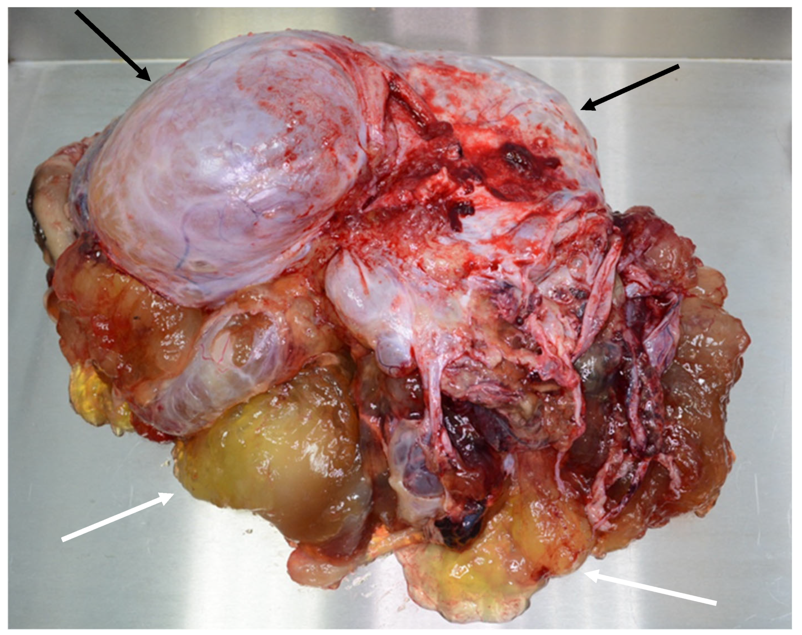 Diagnostics 14 02532 g018