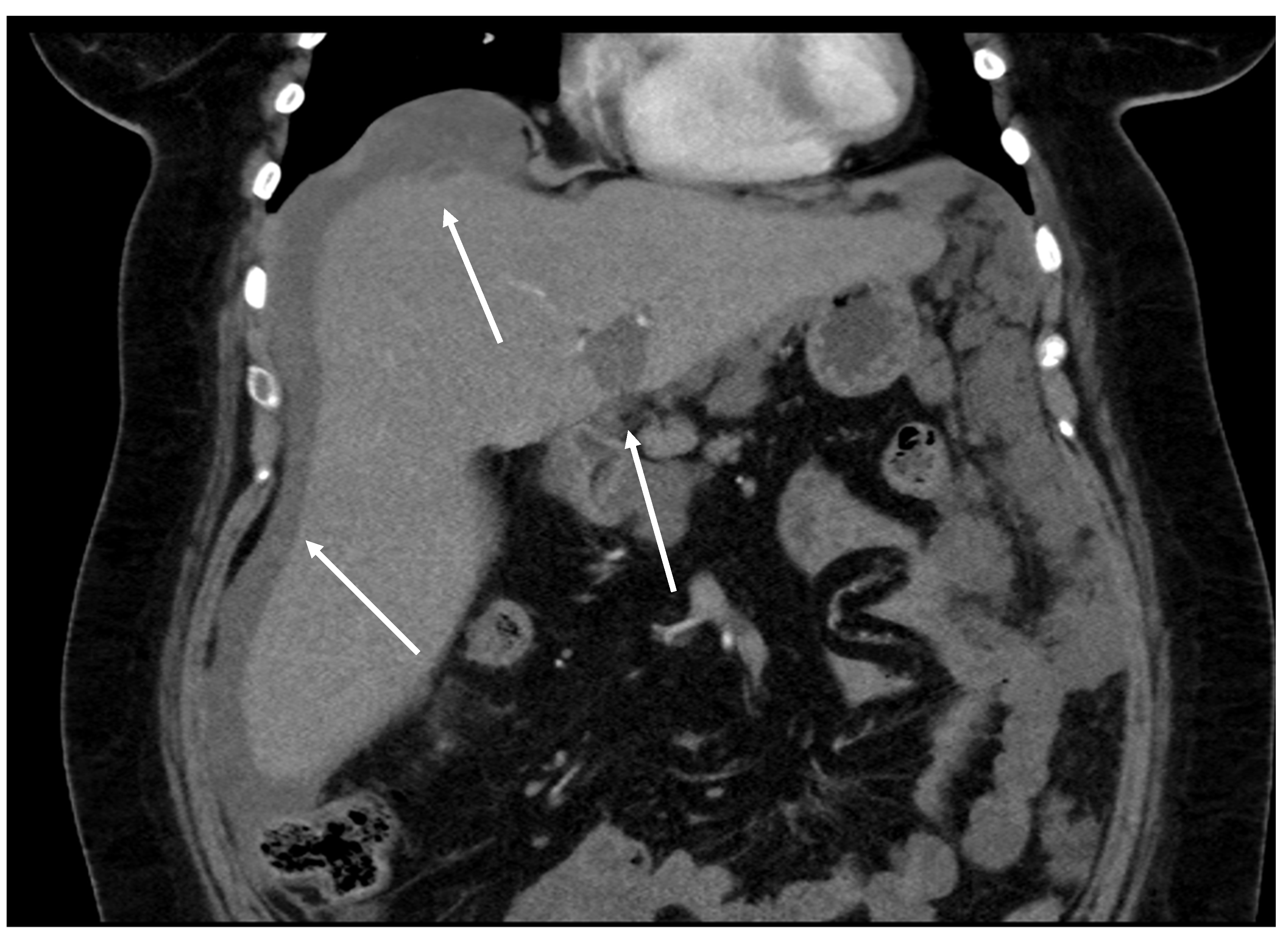 Diagnostics 14 02532 g020
