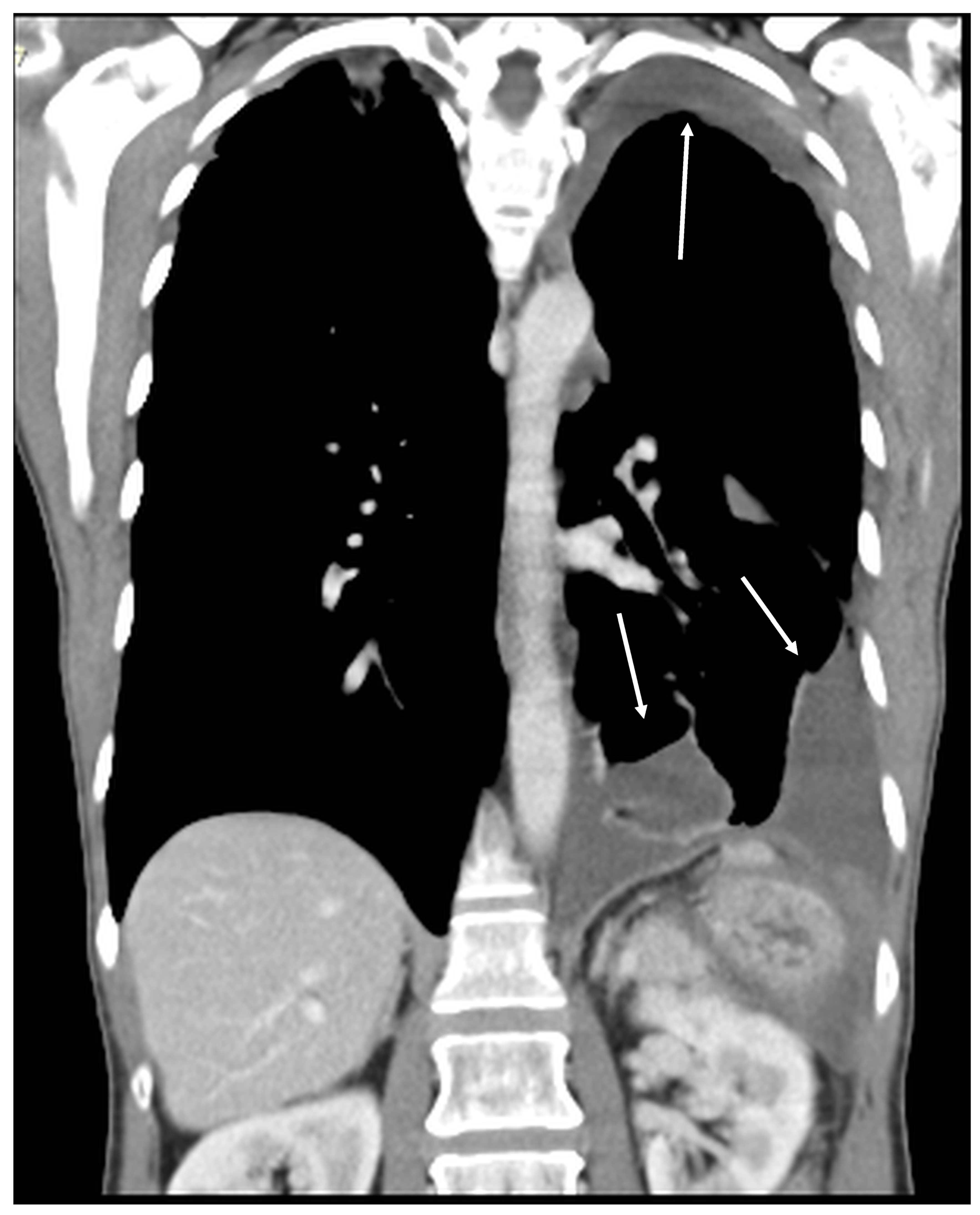 Diagnostics 14 02532 g021