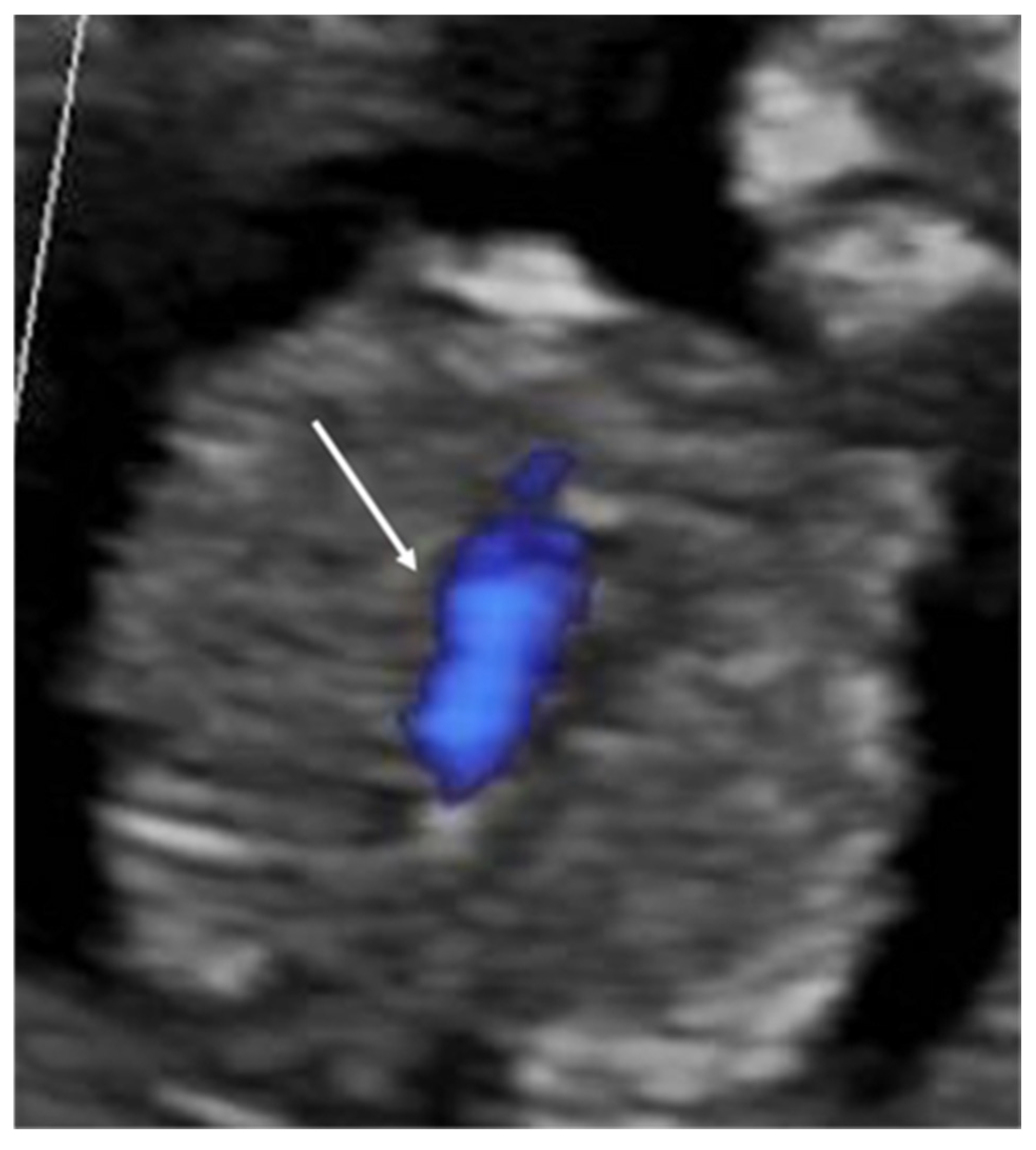 Diagnostics 14 02543 g003