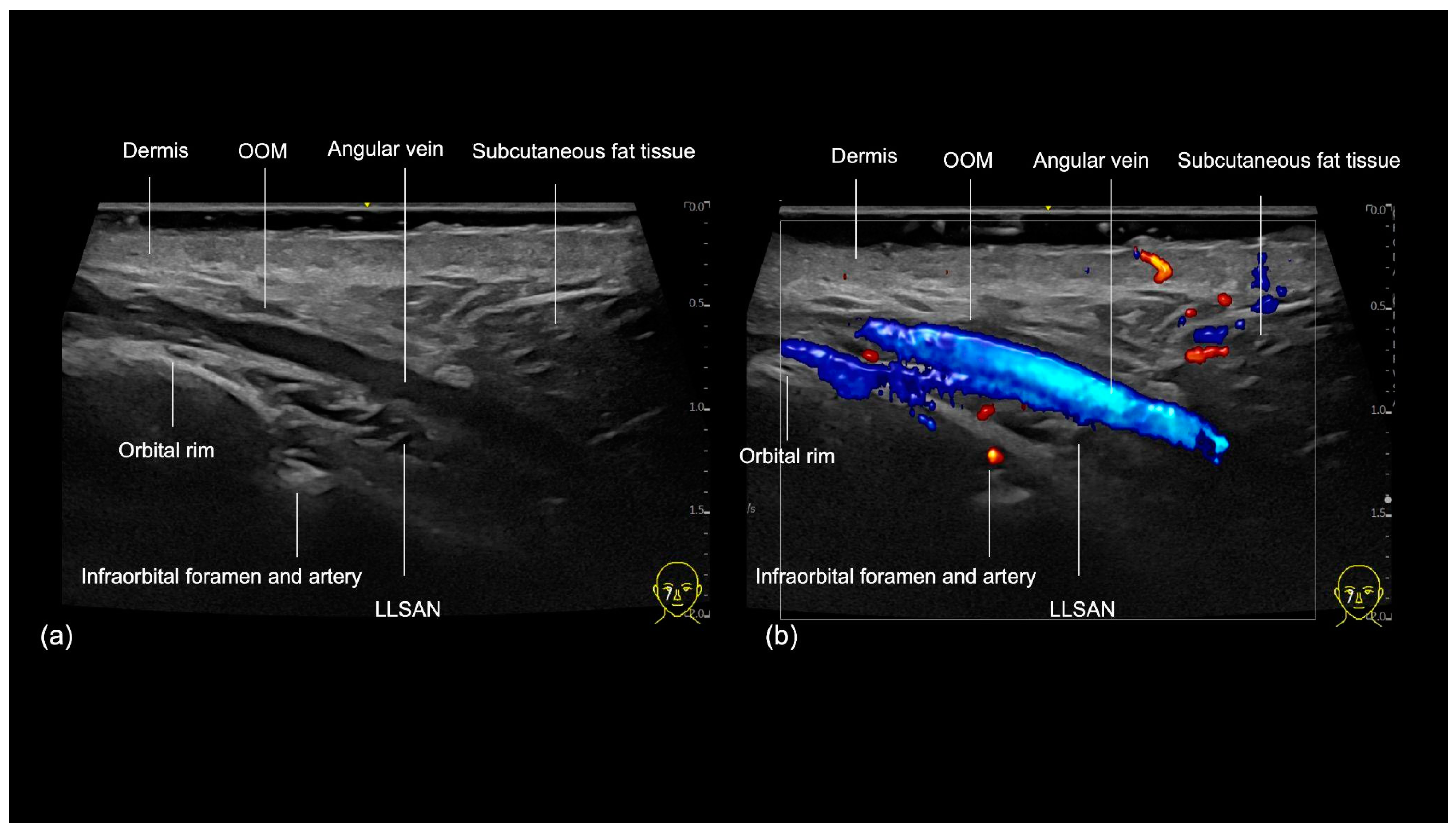Diagnostics 14 02544 g004