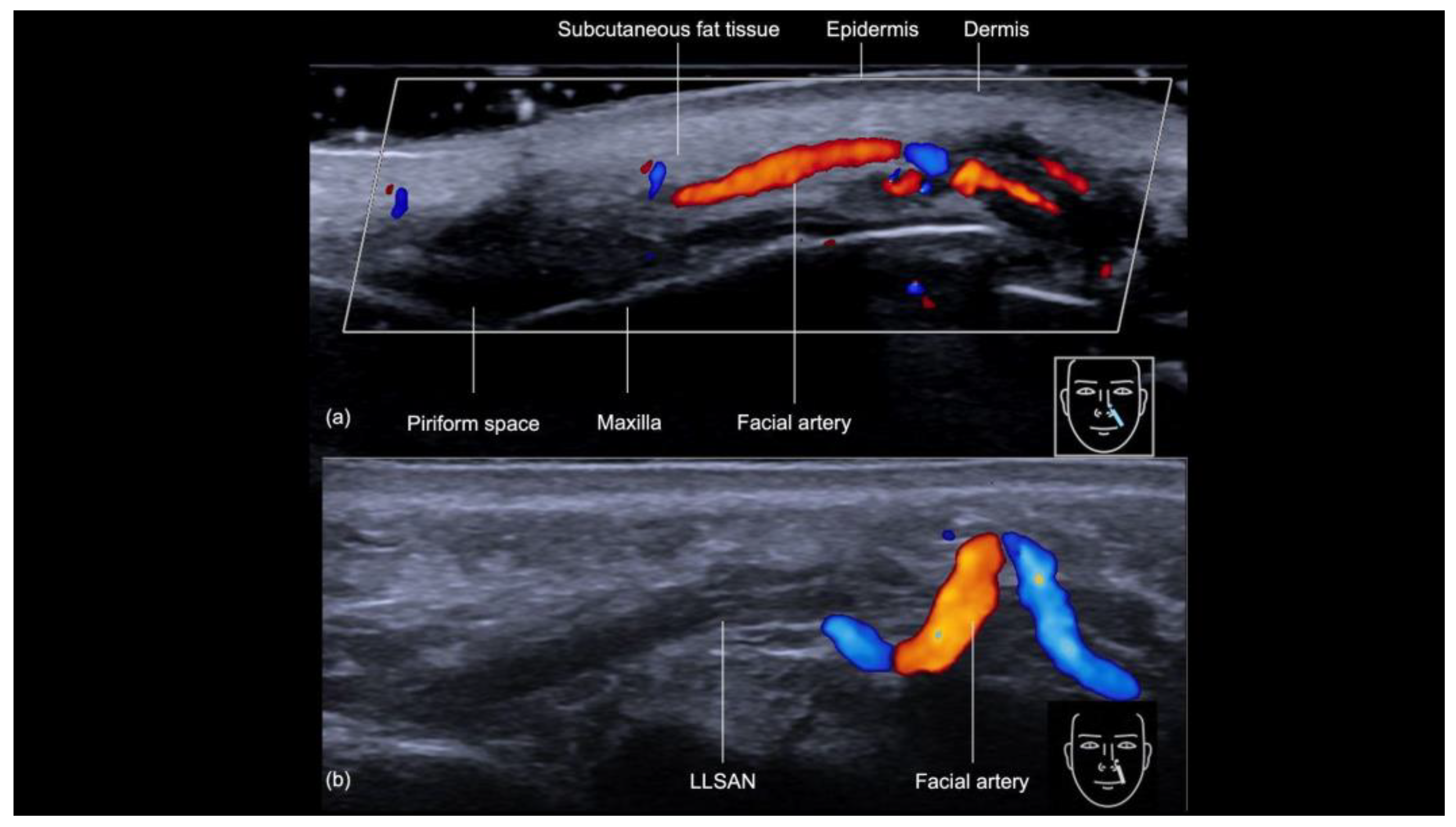 Diagnostics 14 02544 g009