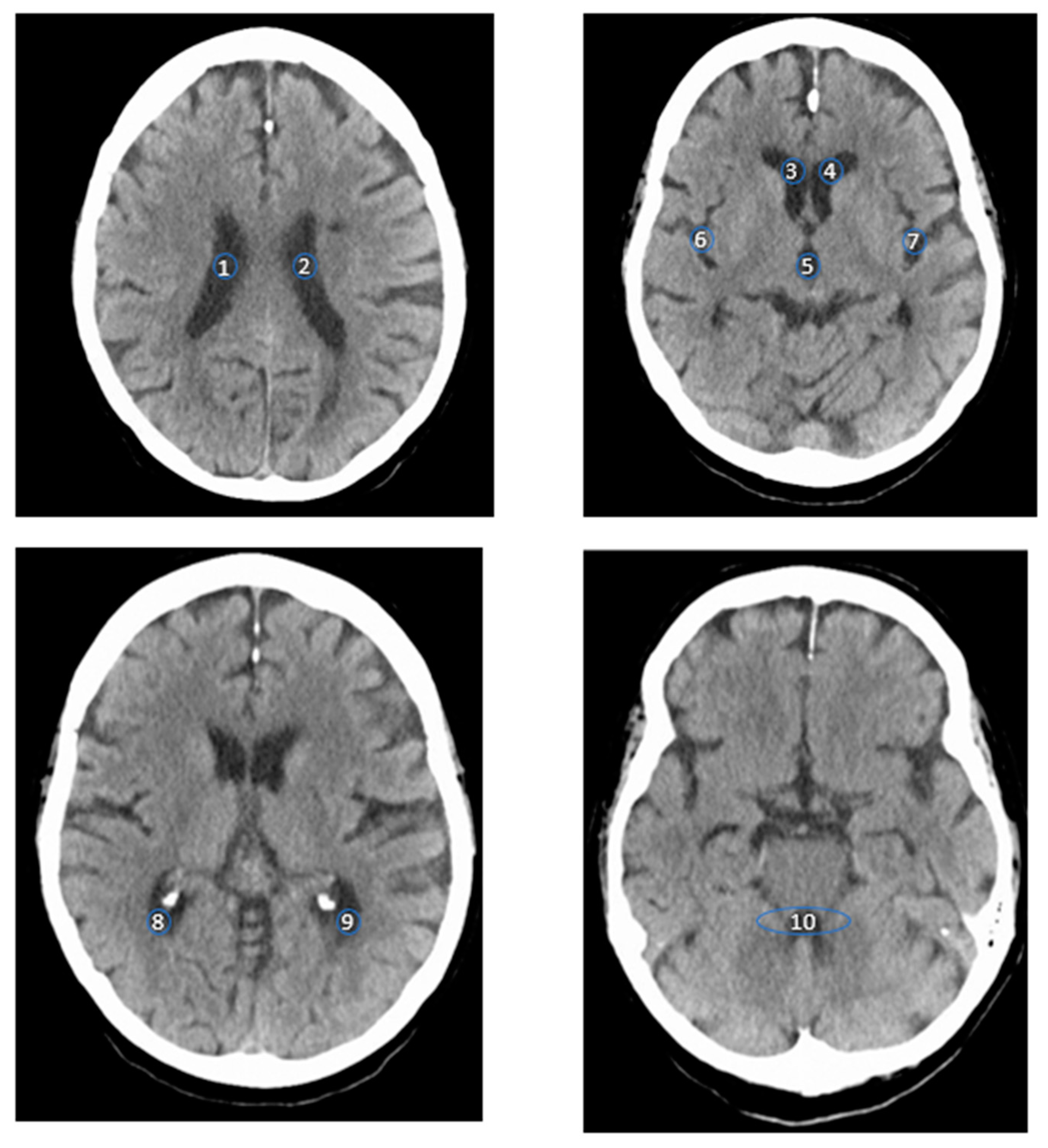 Diagnostics 14 02551 g001