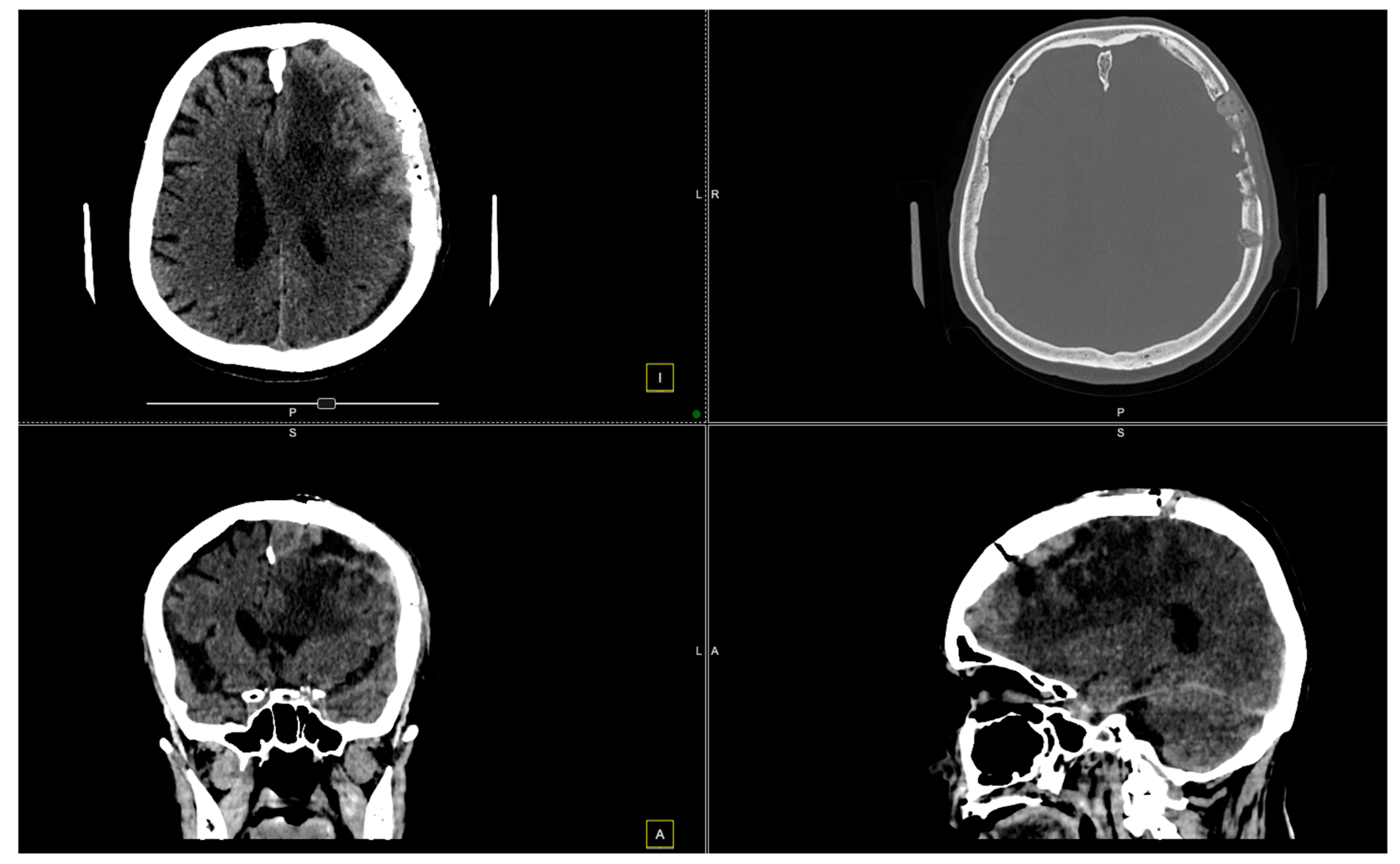 Diagnostics 14 02566 g005