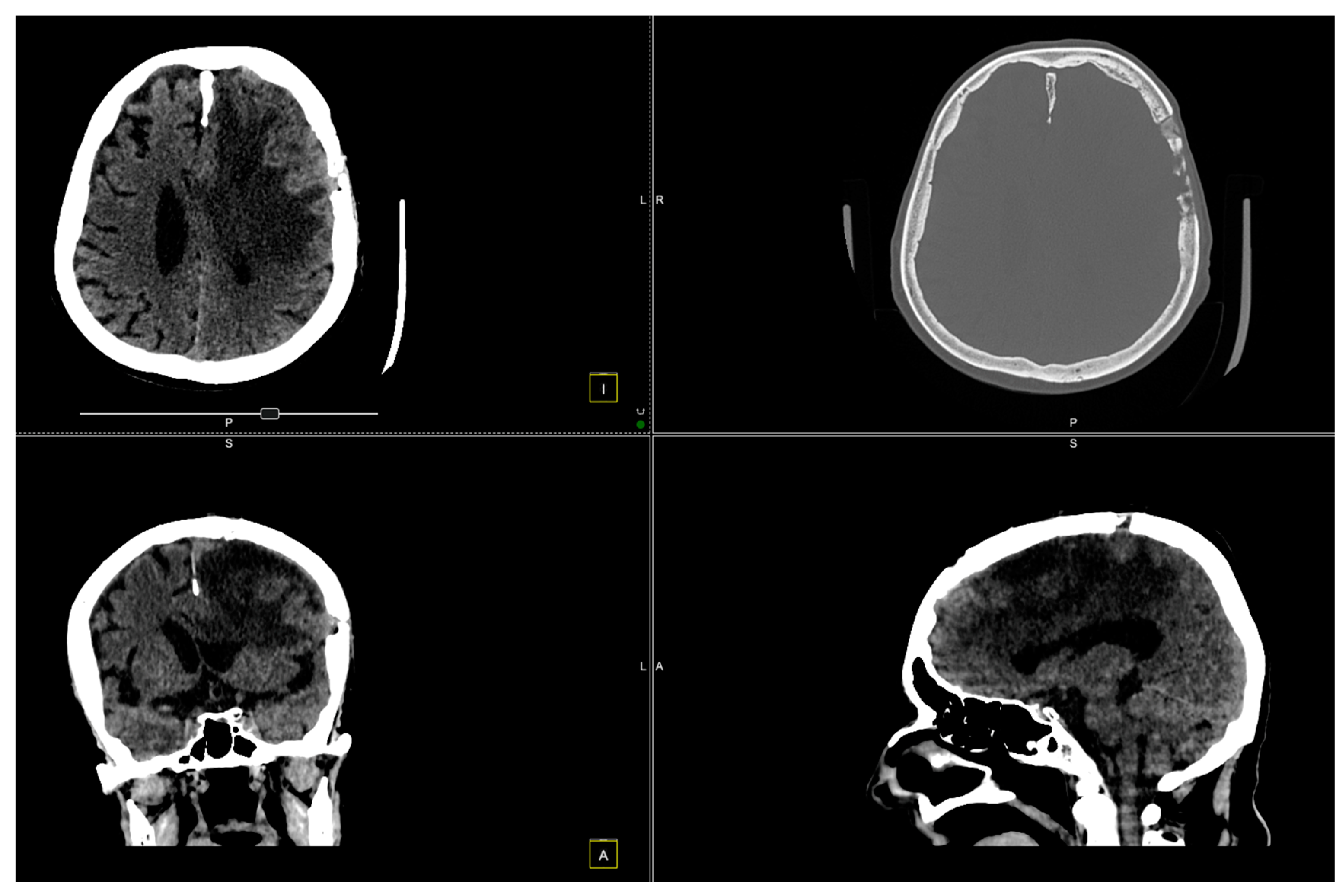 Diagnostics 14 02566 g006