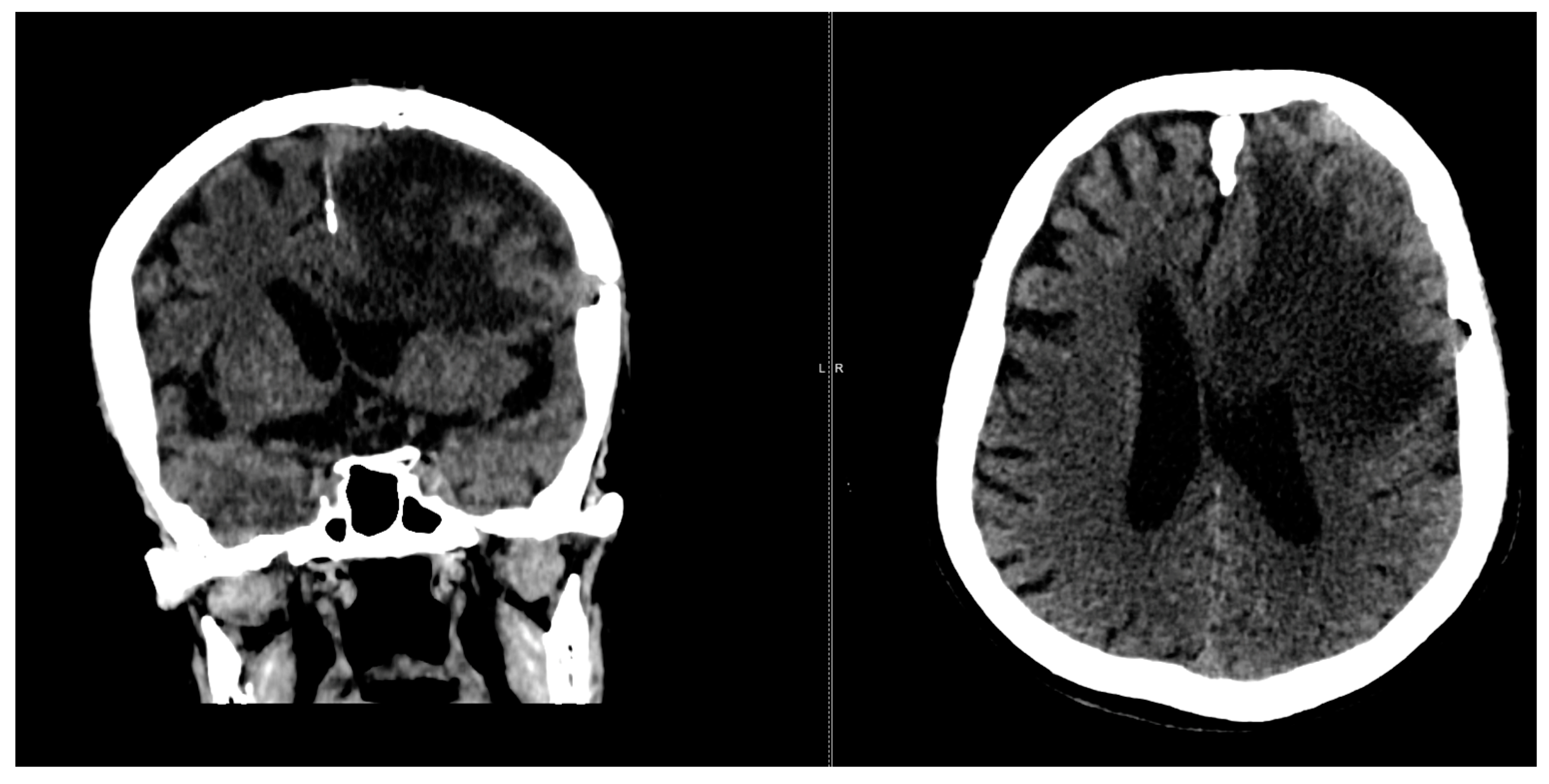 Diagnostics 14 02566 g007