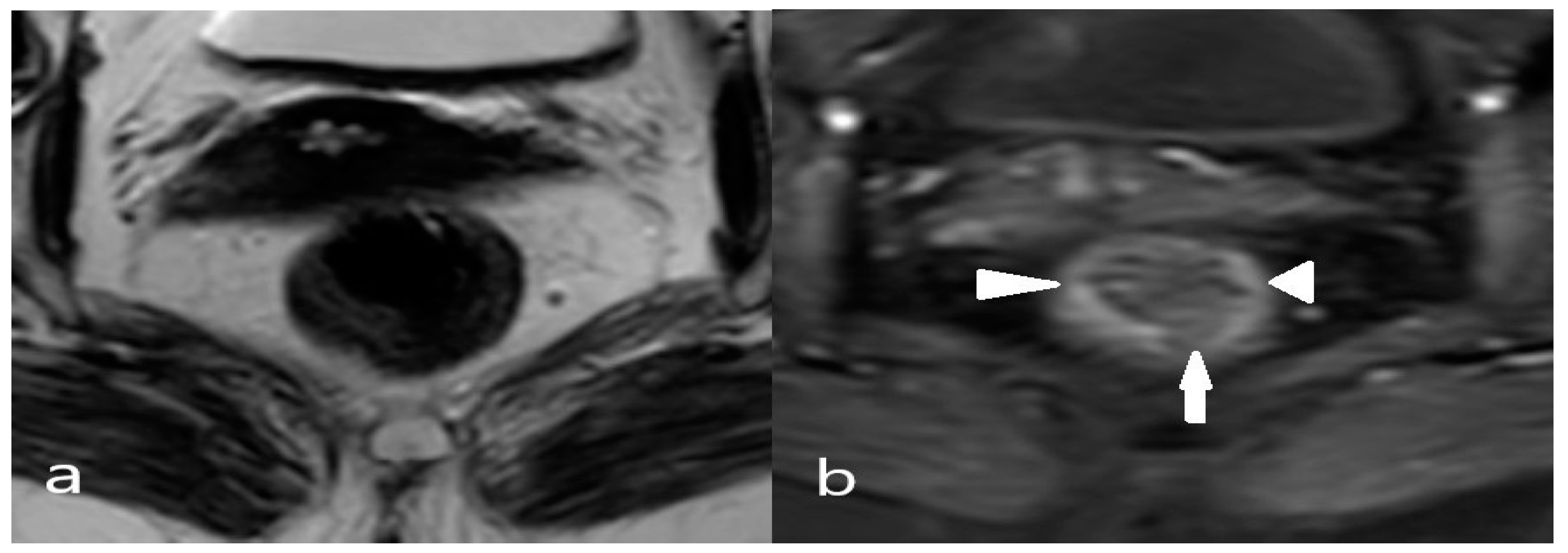 Diagnostics 14 02570 g001