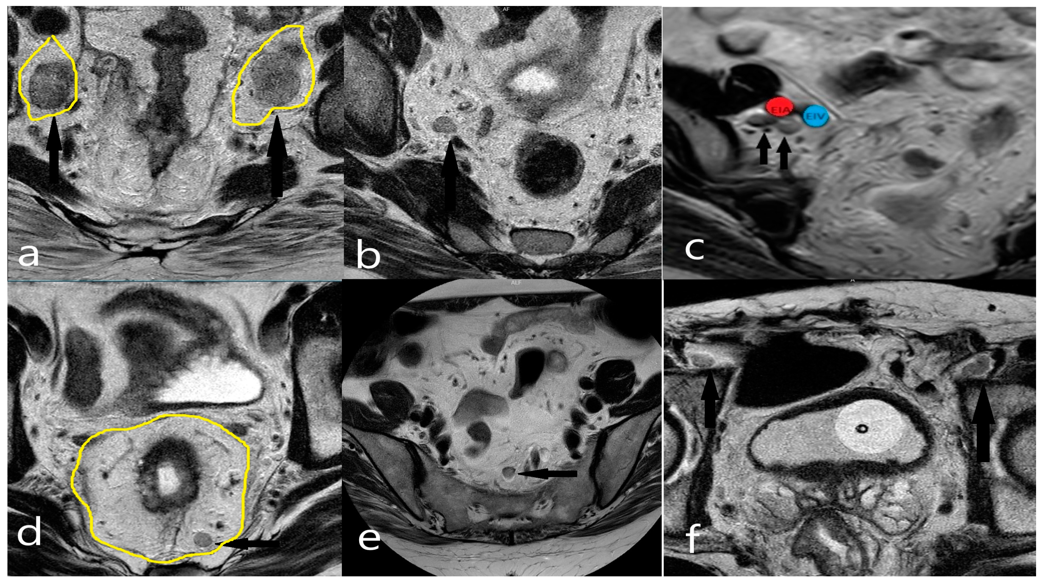 Diagnostics 14 02570 g003