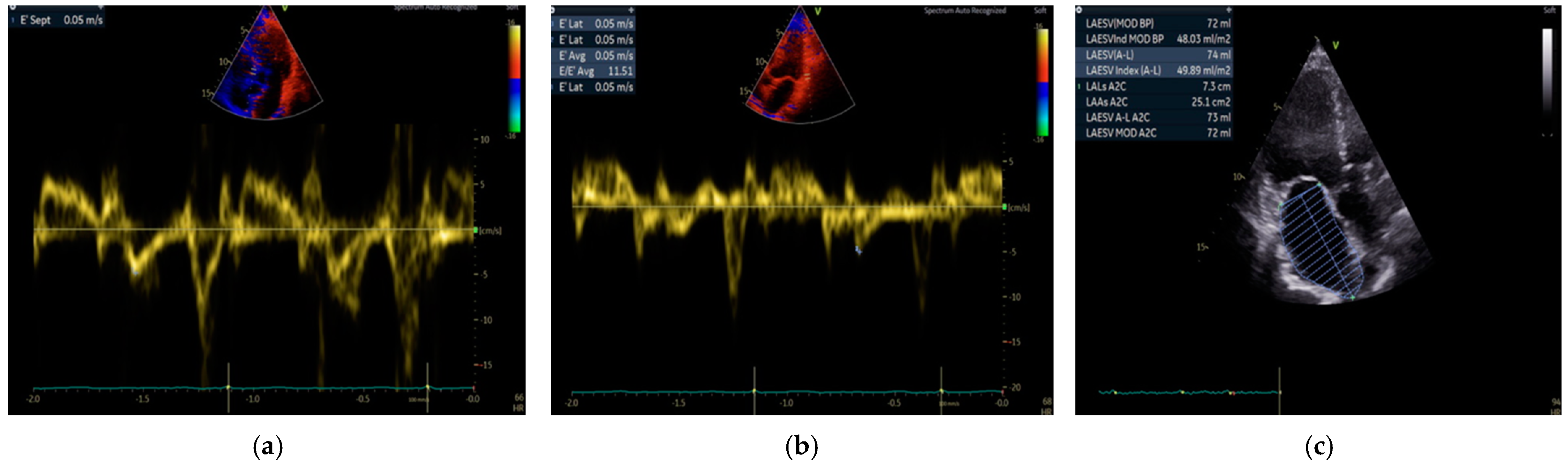 Diagnostics 14 02579 g003