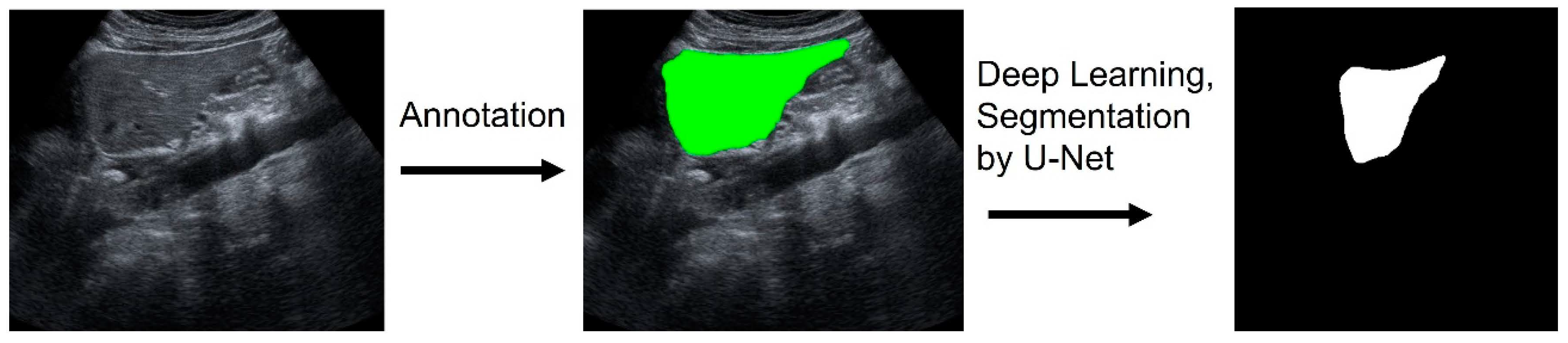 Diagnostics 14 02585 g002