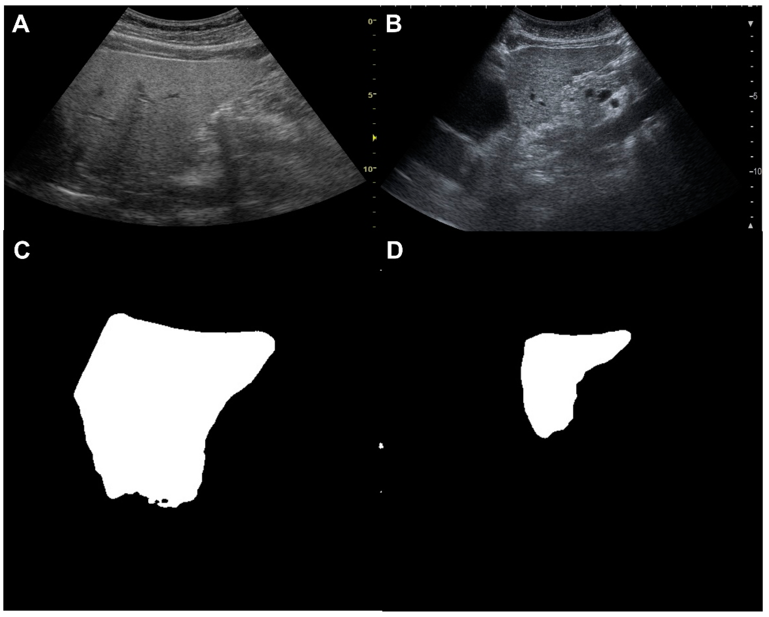 Diagnostics 14 02585 g008