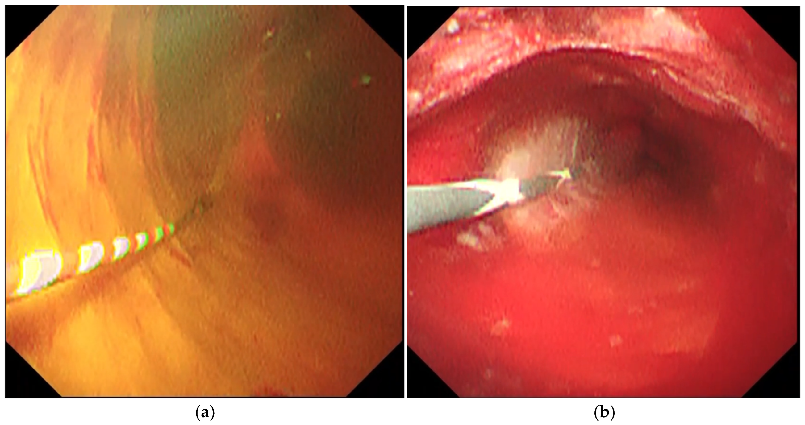Diagnostics 14 02589 g001