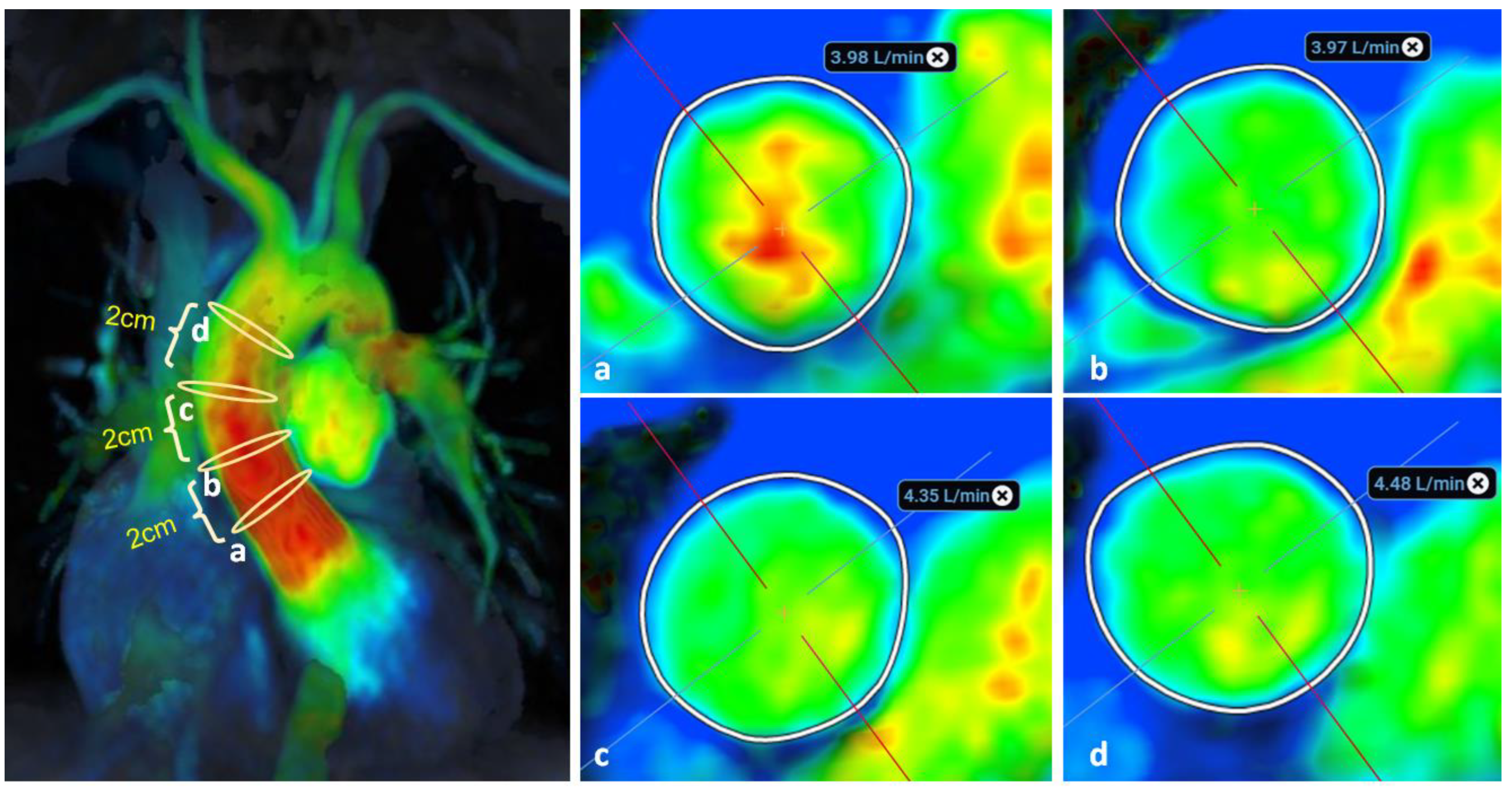 Diagnostics 14 02590 g008