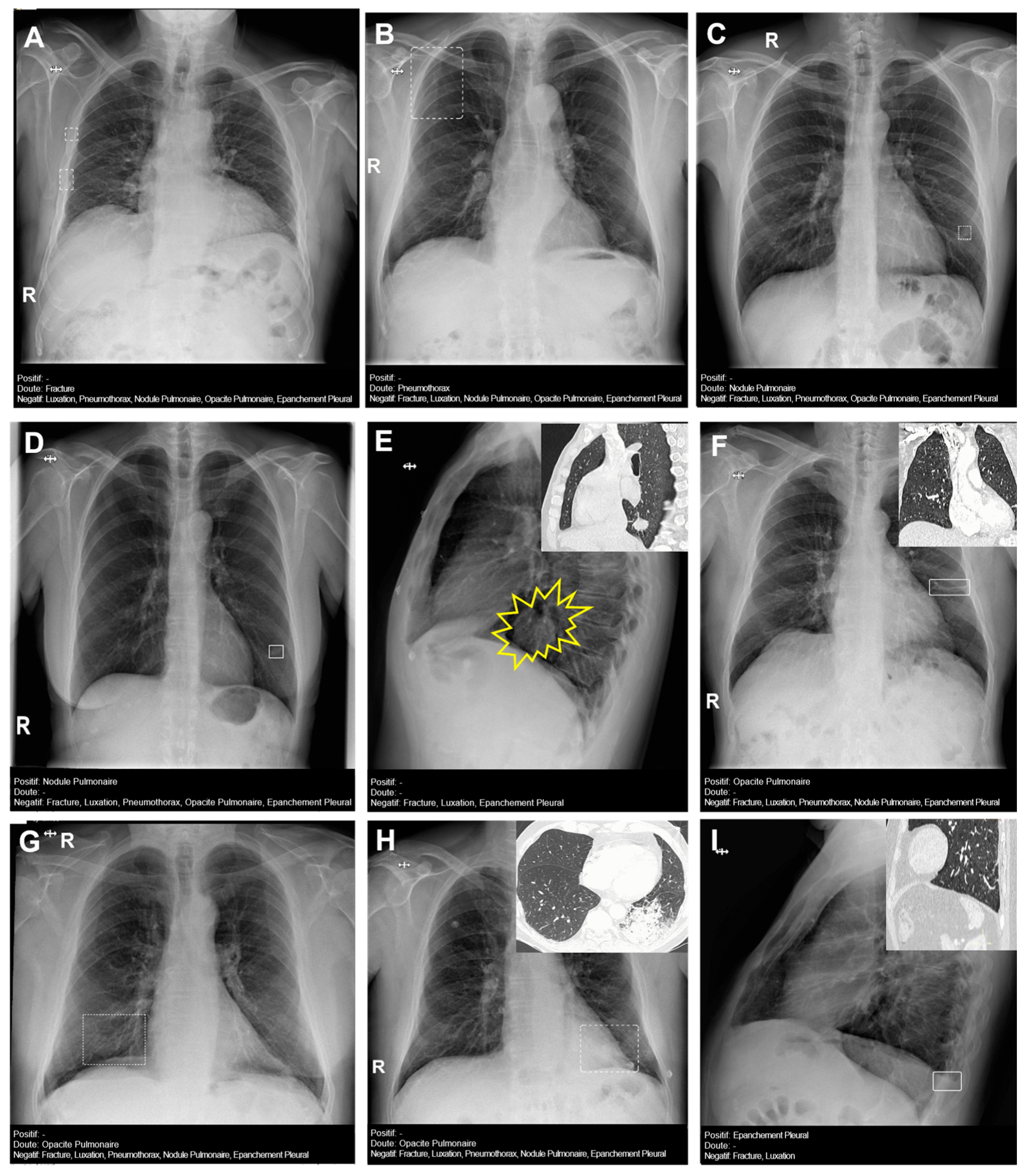 Diagnostics 14 02592 g004