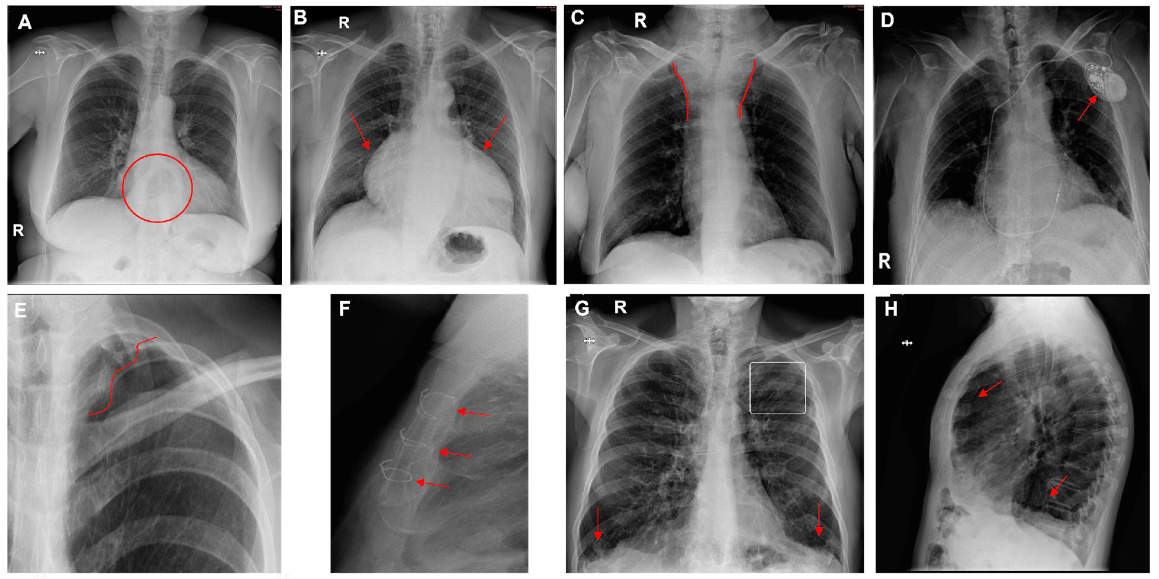 Diagnostics 14 02592 g006