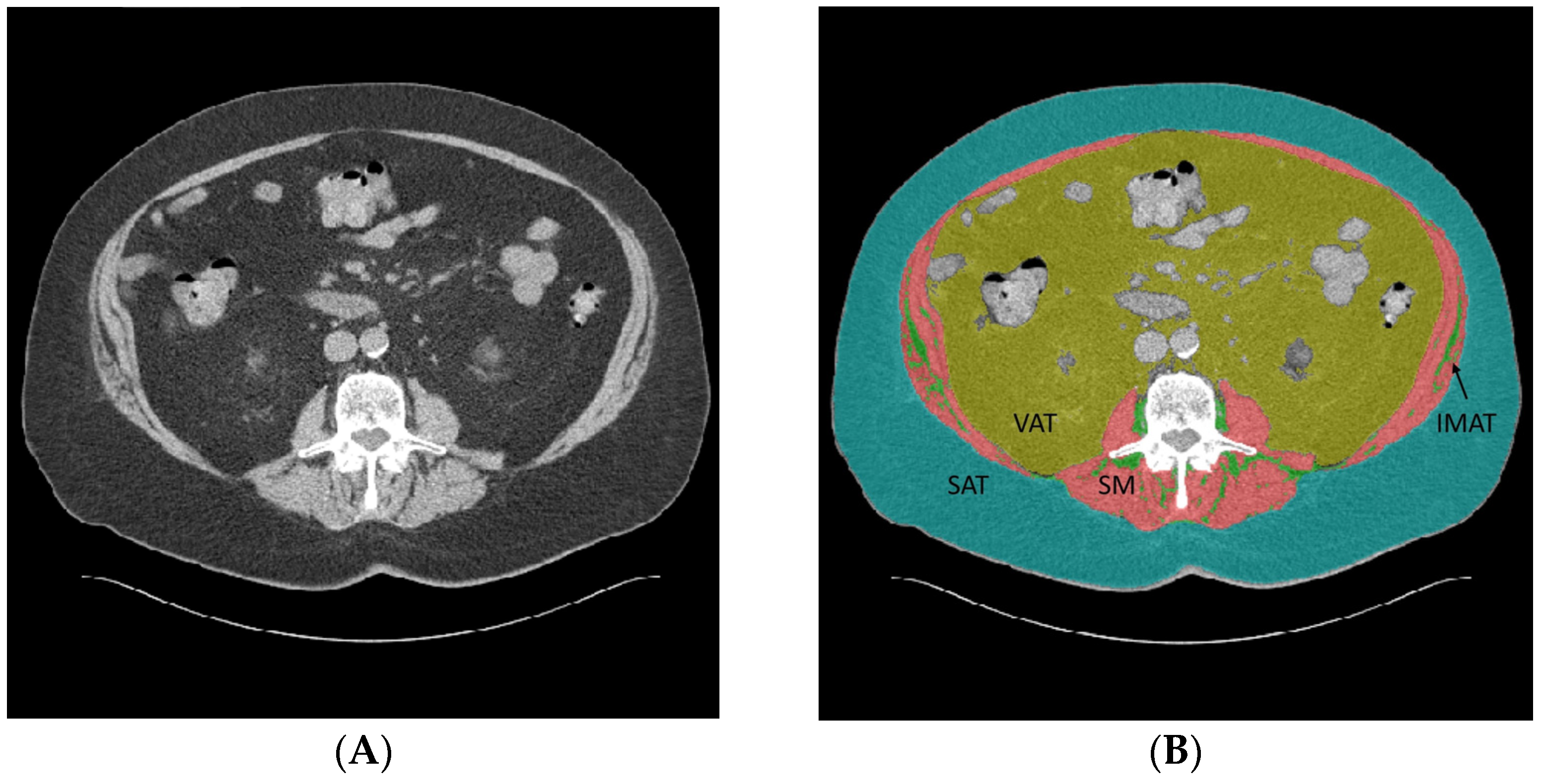 Diagnostics 14 02593 g001a