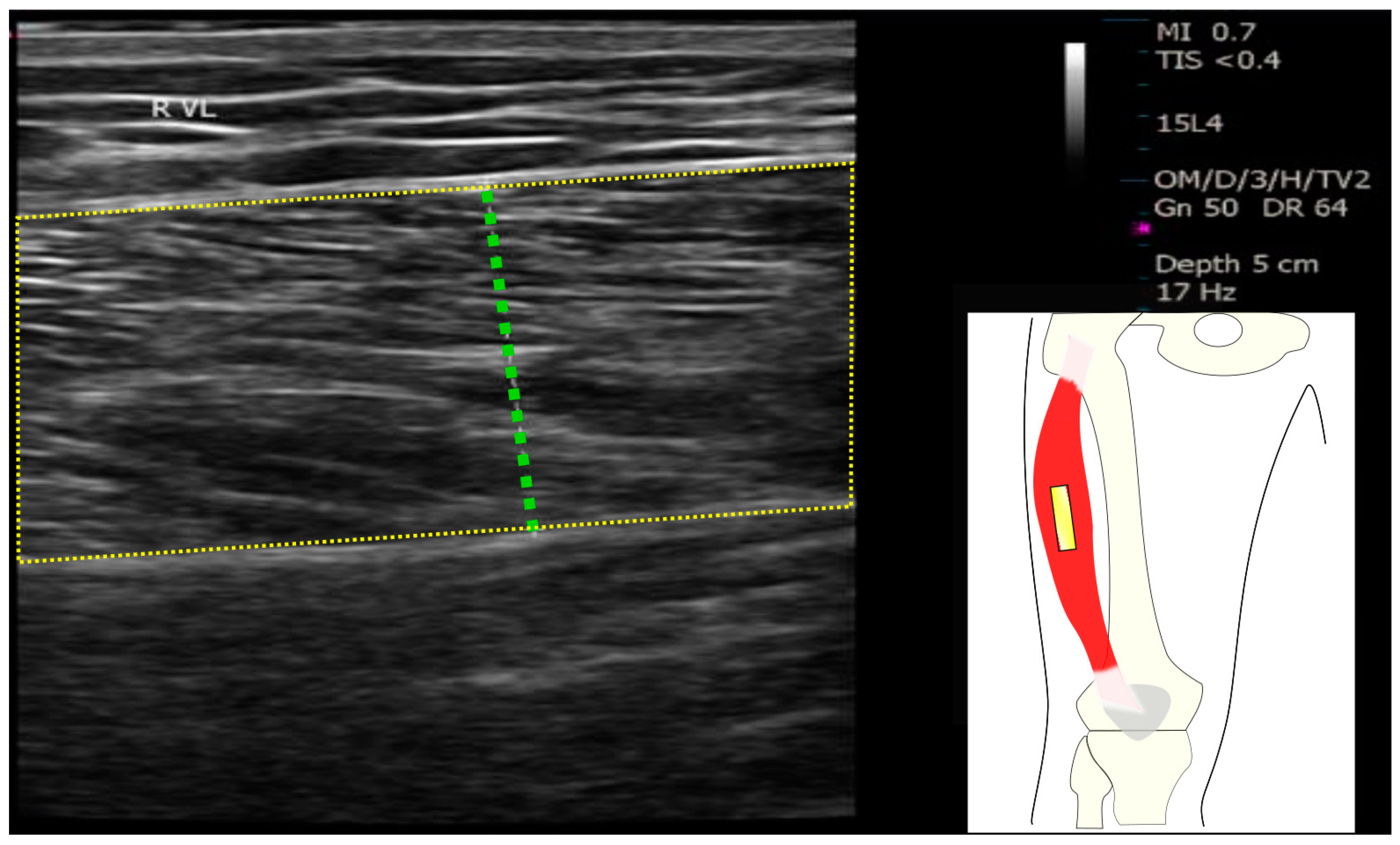 Diagnostics 14 02600 g001