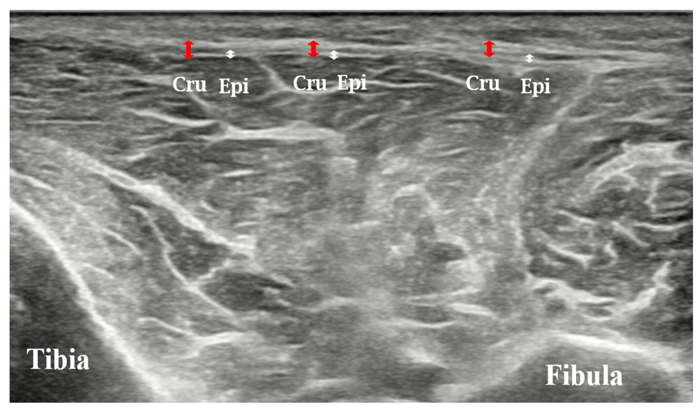 Diagnostics 14 02606 g002 Diagnostics 14 02606 g002