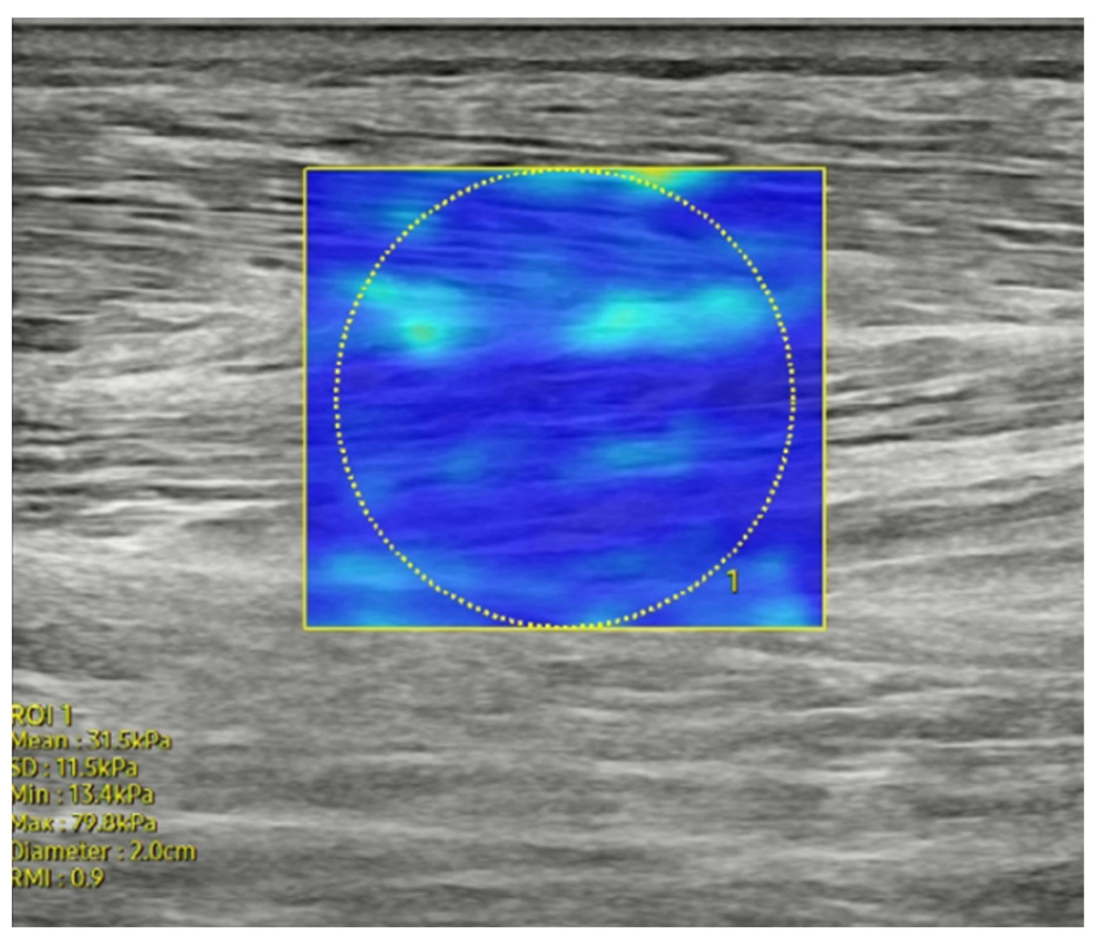 Diagnostics 14 02606 g003 Diagnostics 14 02606 g003