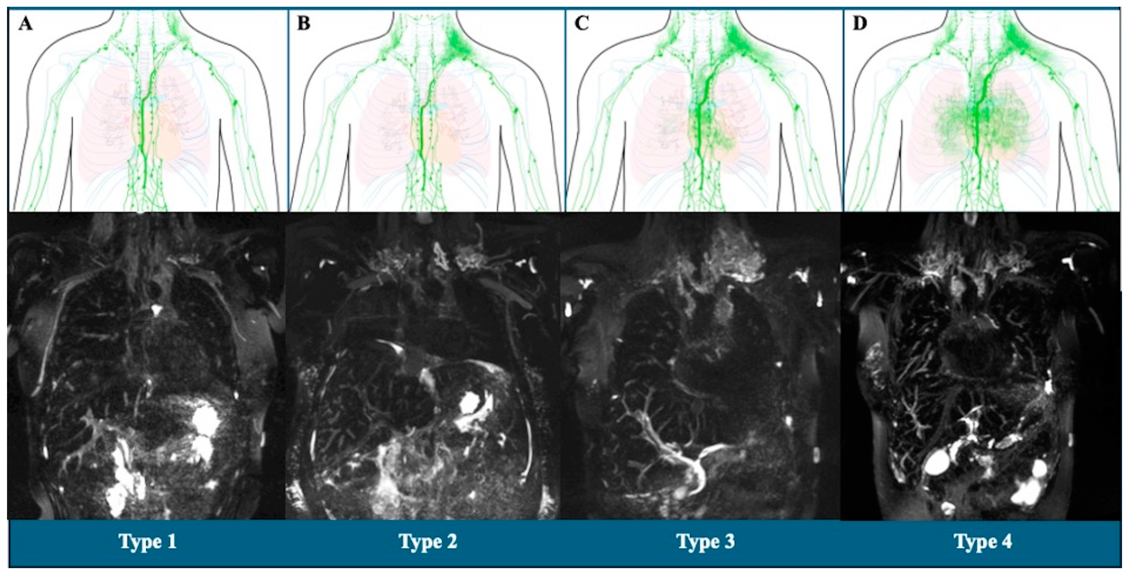 Diagnostics 14 02611 g001