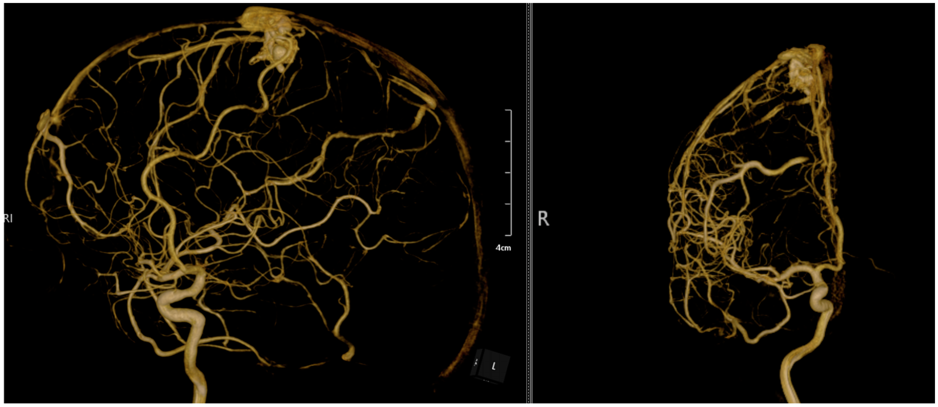Diagnostics 14 02613 g003