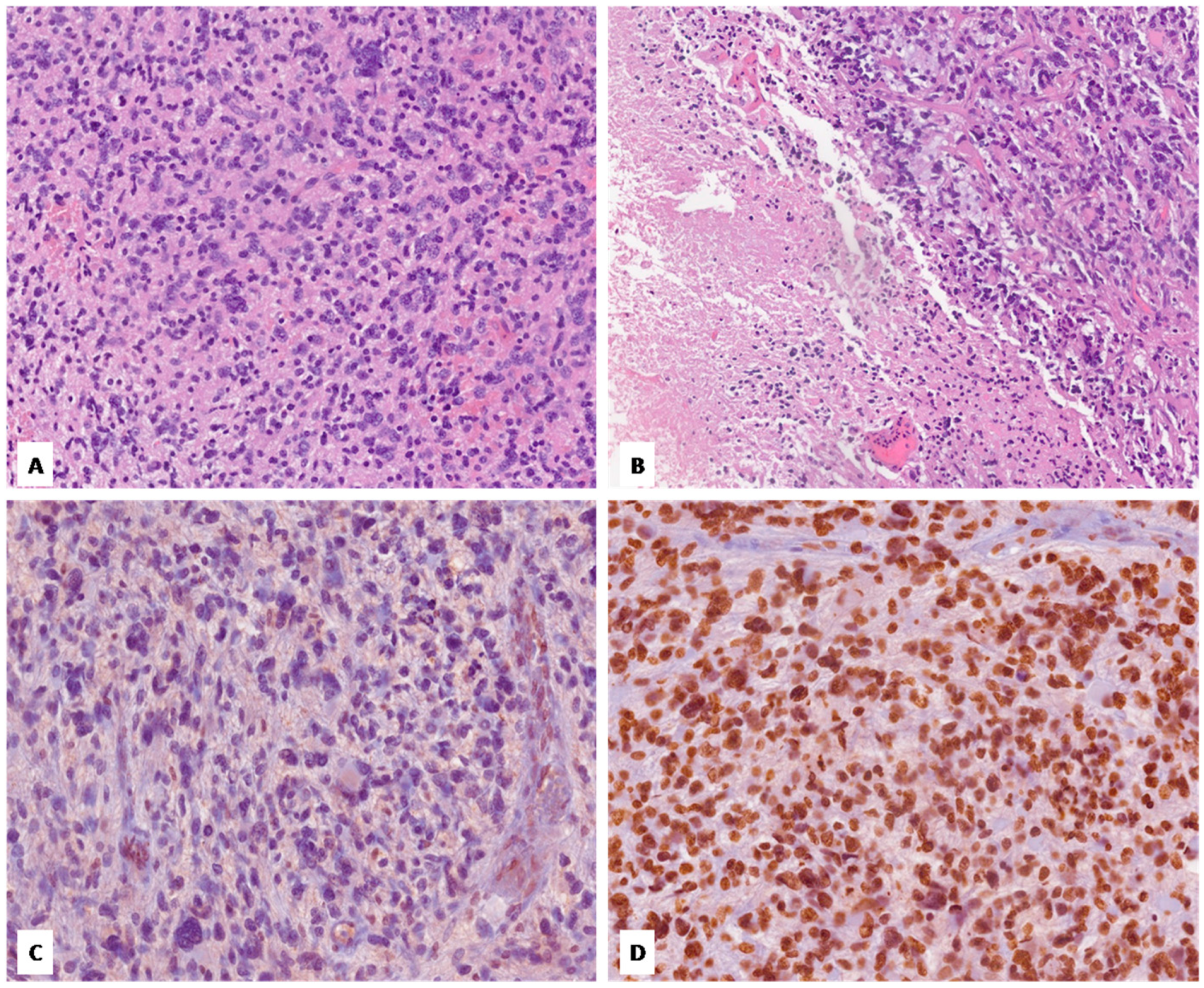 Diagnostics 14 02617 g001