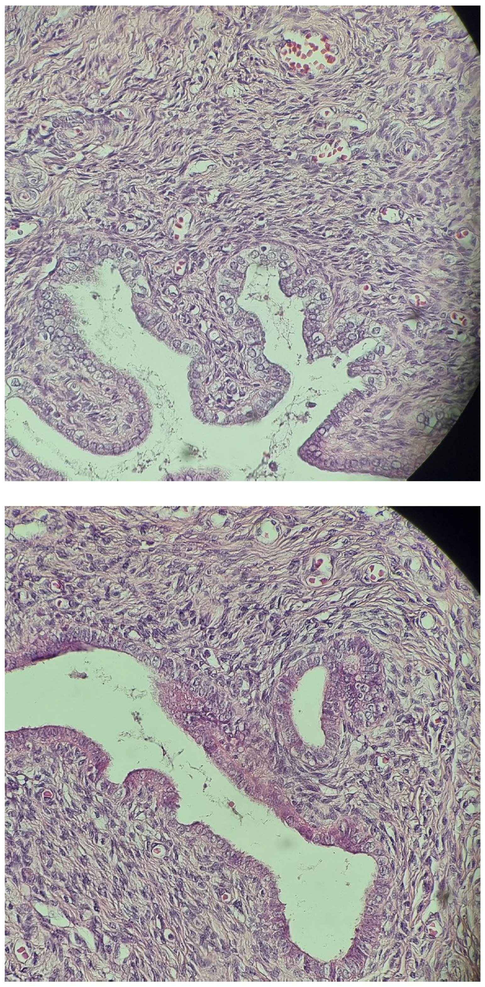 Diagnostics 14 02621 g002b Diagnostics 14 02621 g002b